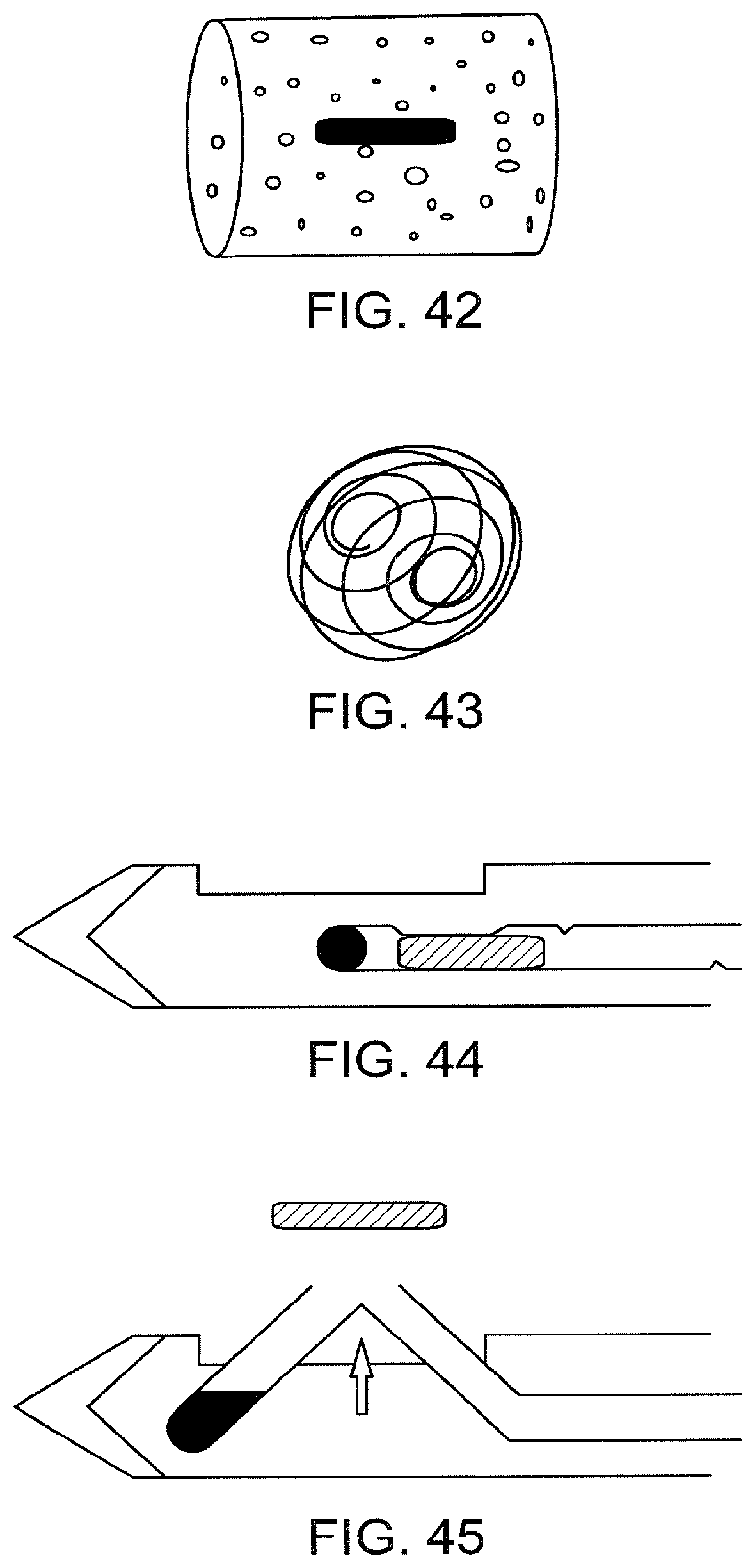 Patent US12102491 Figure 10 – Biopsy marker