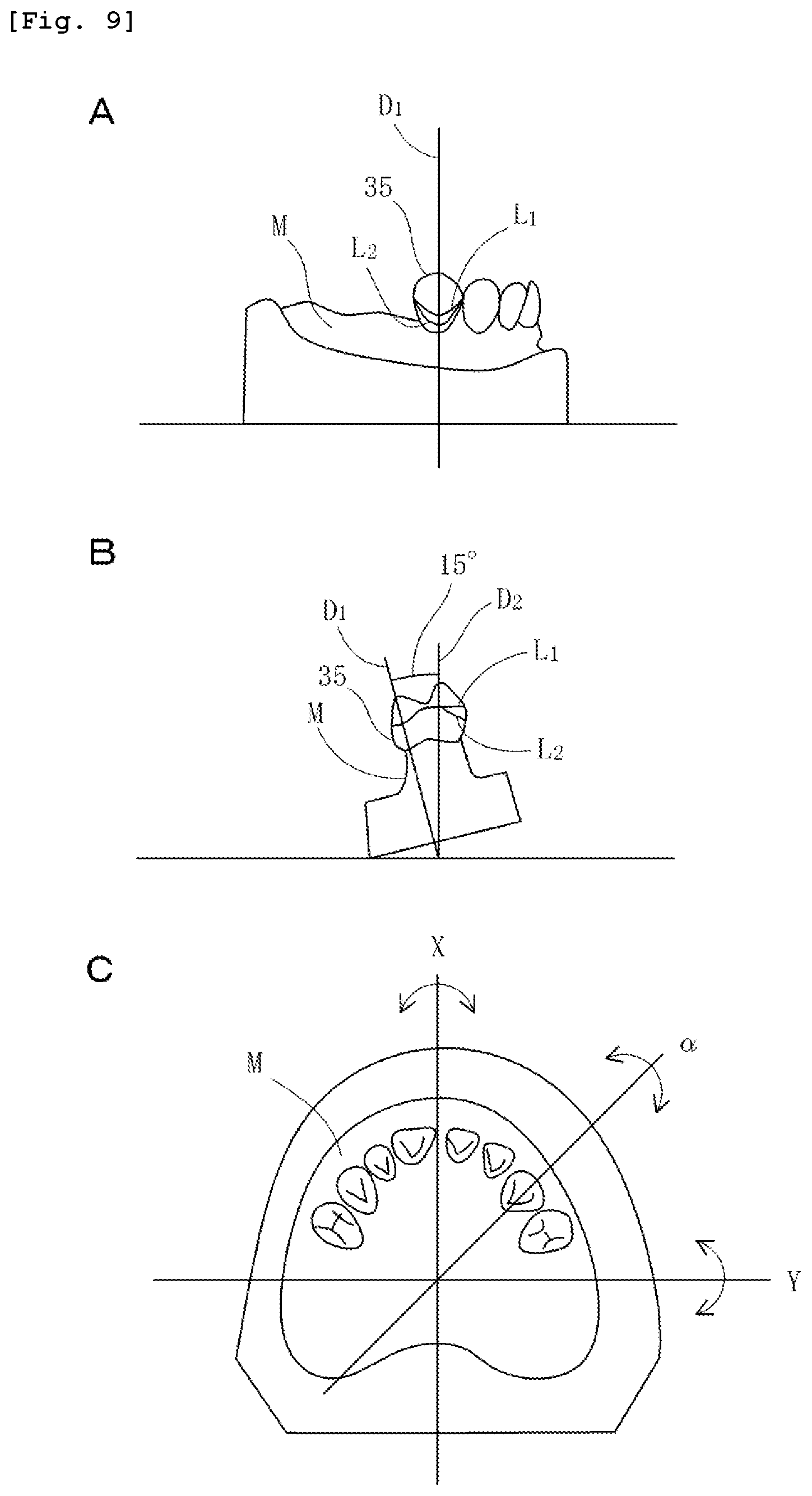 Patent US12102496 Figure 9 – Angle adjustment stage device for dental technique