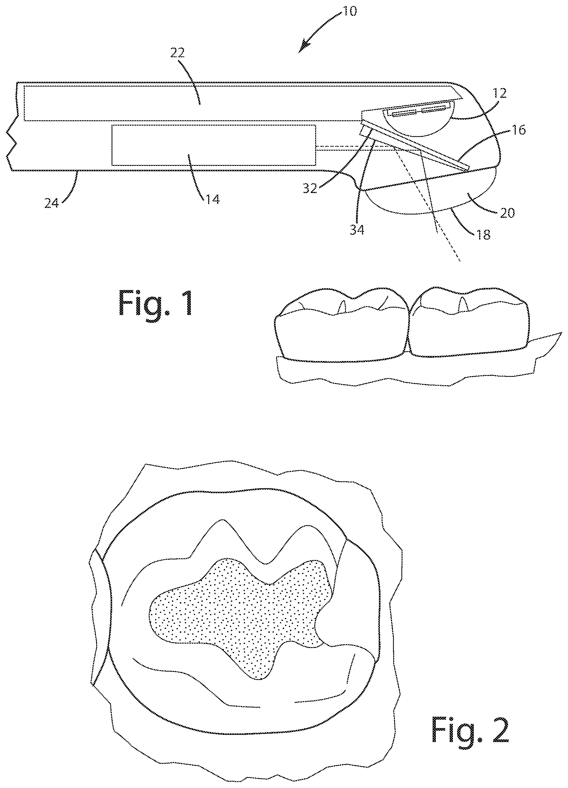 Patent US12102498 Figure 1 – Dental curing light and method