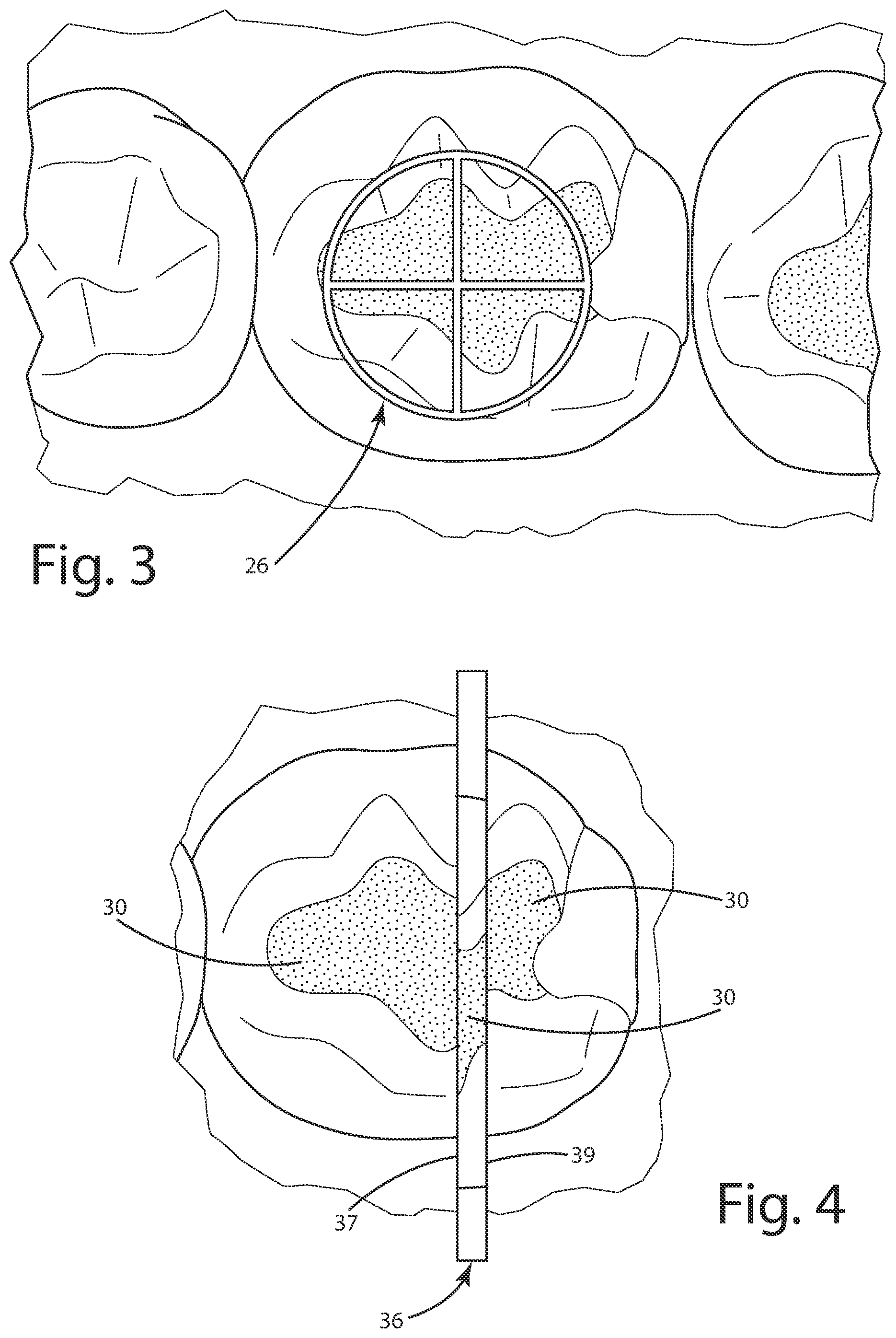 Patent US12102498 Figure 2 – Dental curing light and method