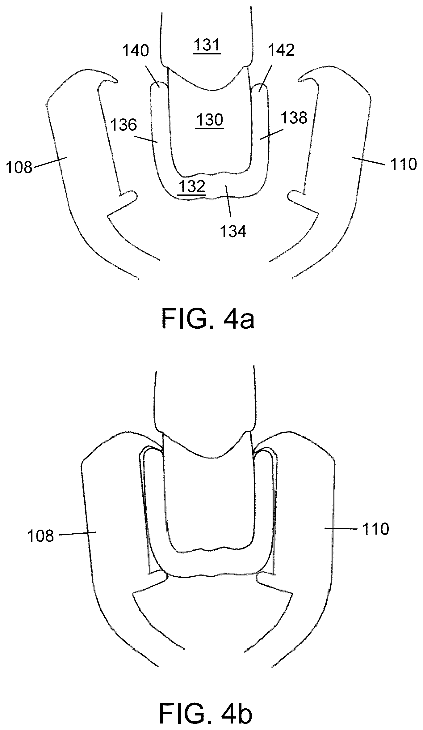 Patent US12102500 Figure 4 – Orthodontic aligner removal device and method