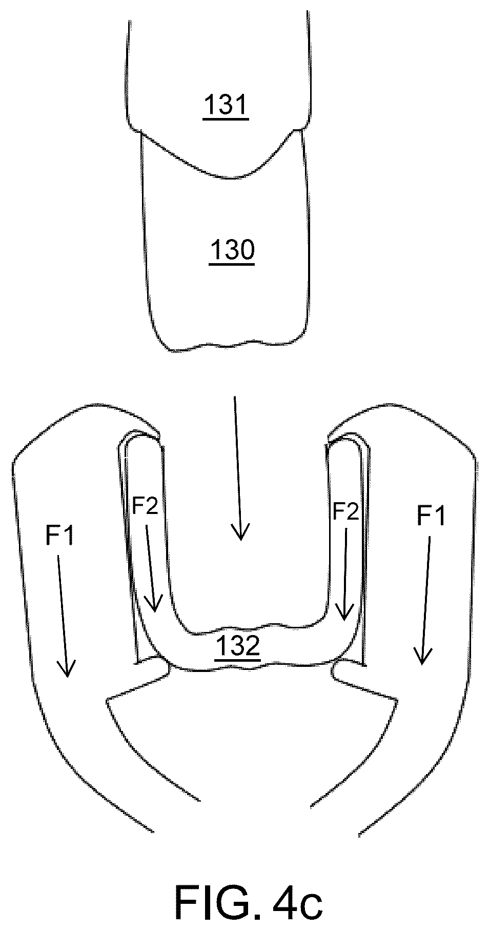 Patent US12102500 Figure 5 – Orthodontic aligner removal device and method