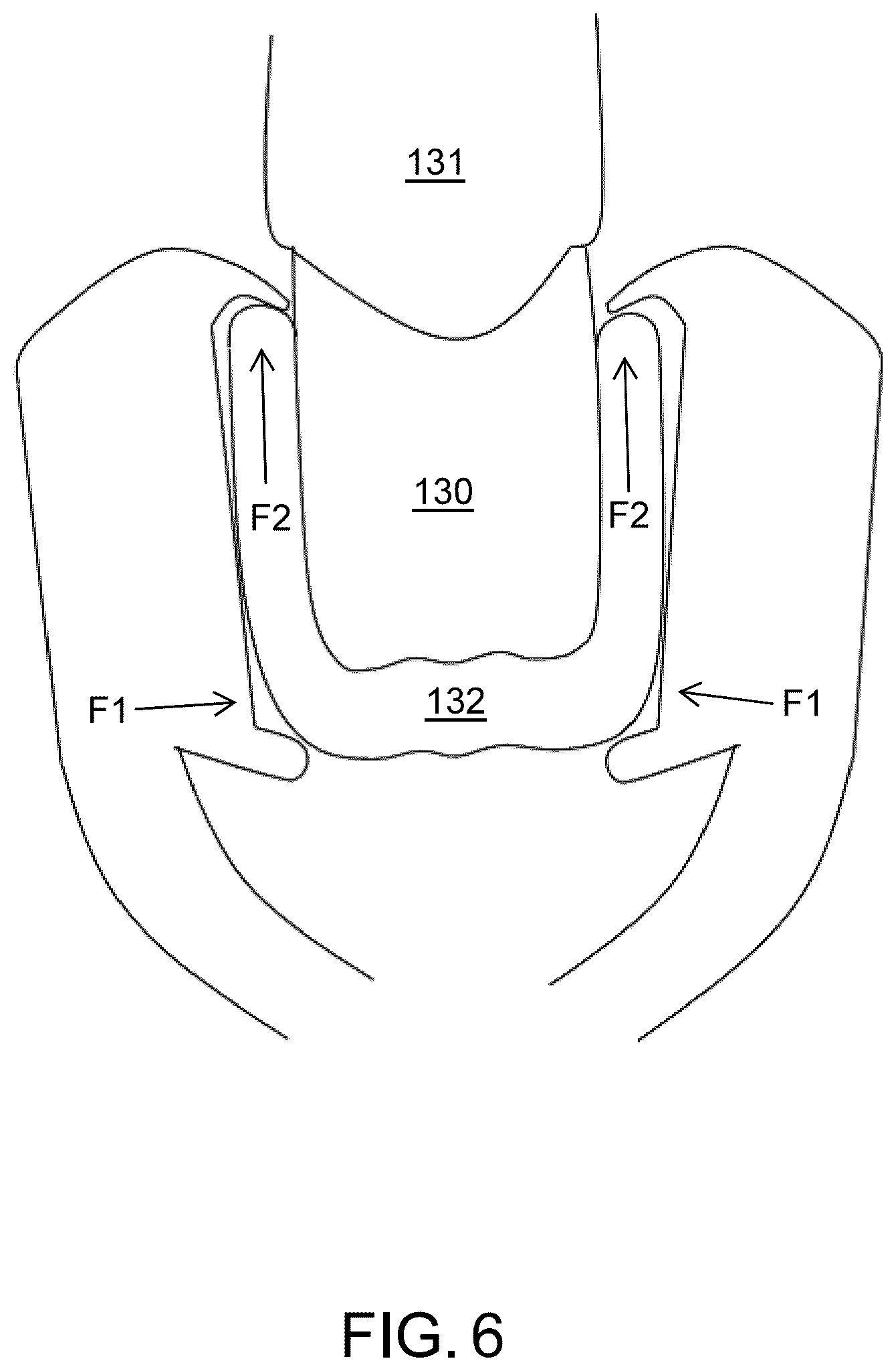 Patent US12102500 Figure 7 – Orthodontic aligner removal device and method