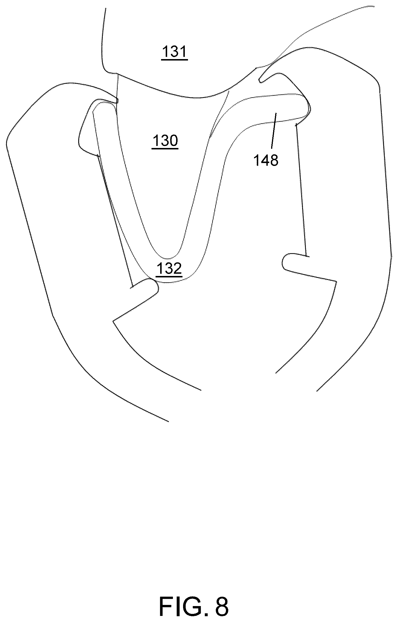 Patent US12102500 Figure 9 – Orthodontic aligner removal device and method