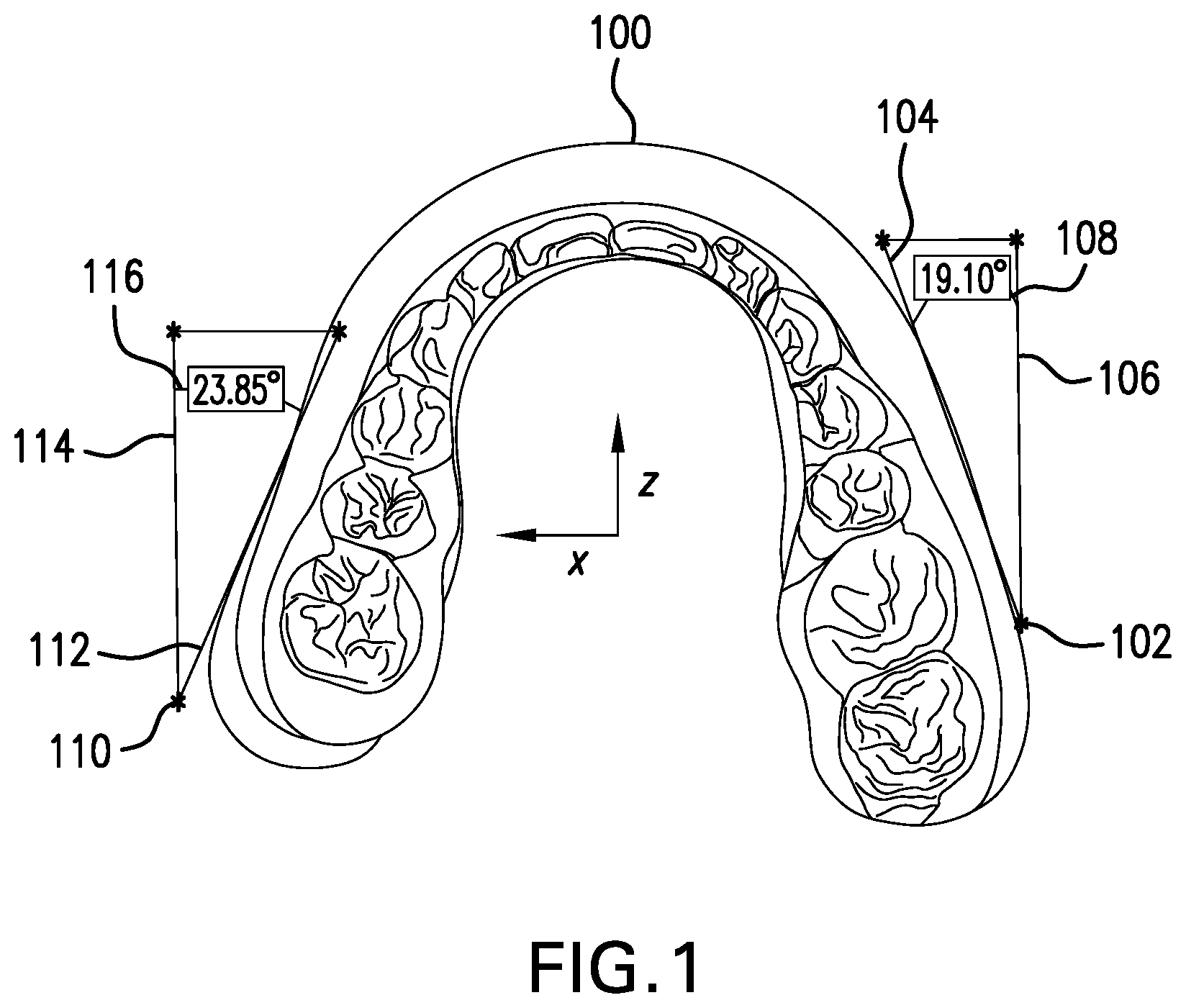 Patent US12102501 Figure 1 – Symmetrical advancement of mandible