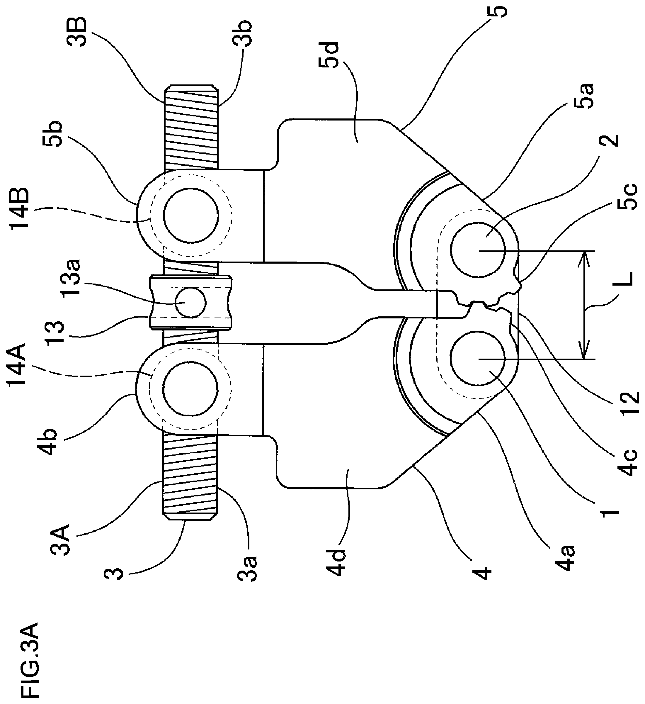 Patent US12102502 Figure 3 – Orthodontic expansion device