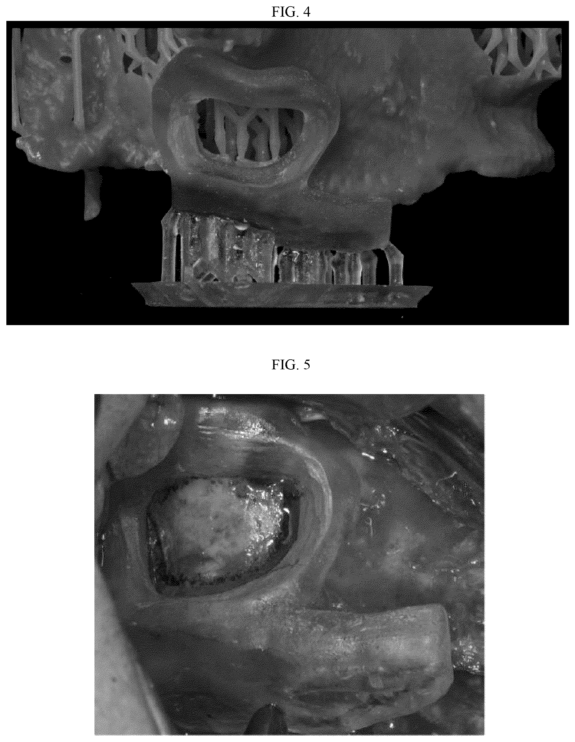 Patent US12102504 Figure 3 – Tooth implant method