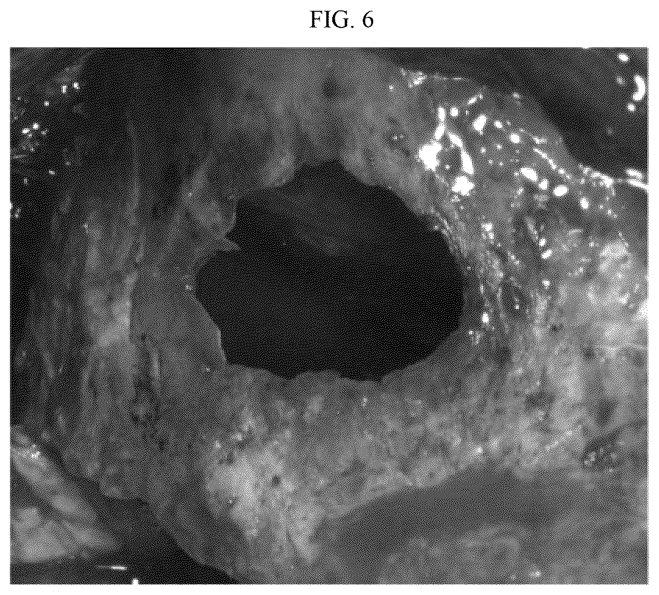 Patent US12102504 Figure 4 – Tooth implant method