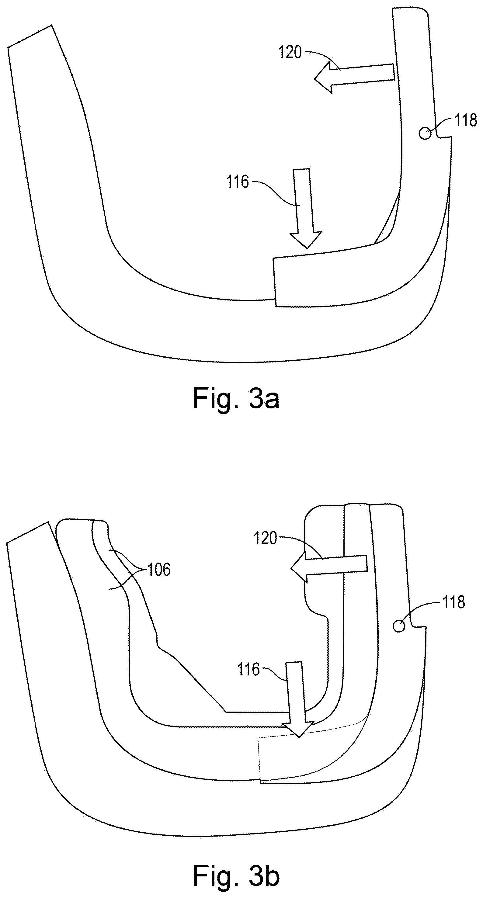 Patent US12102505 Figure 5 – Power-fit single layer cage