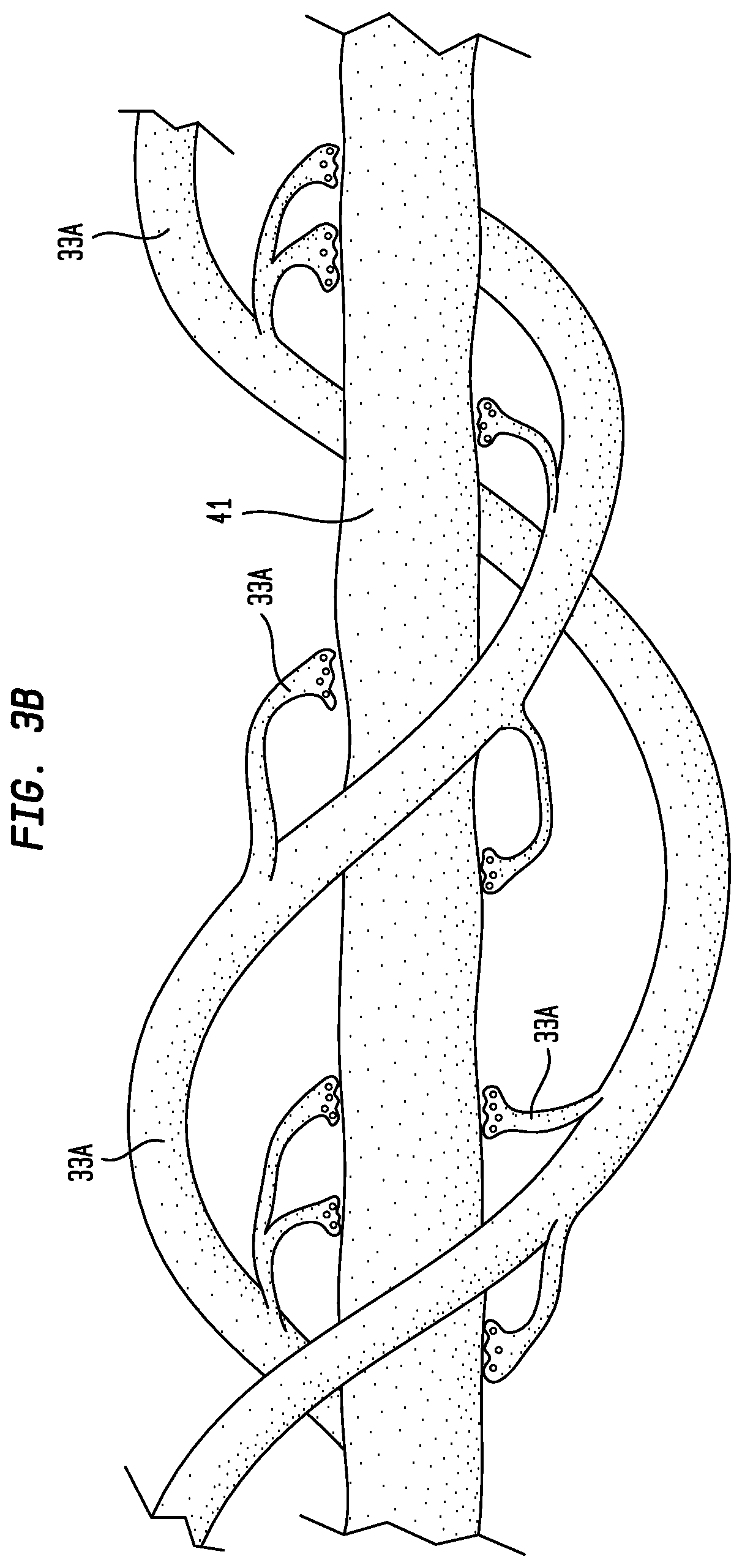 Patent US12102506 Figure 5 – Method for external ear canal pressure regulation to alleviate disorder symptoms