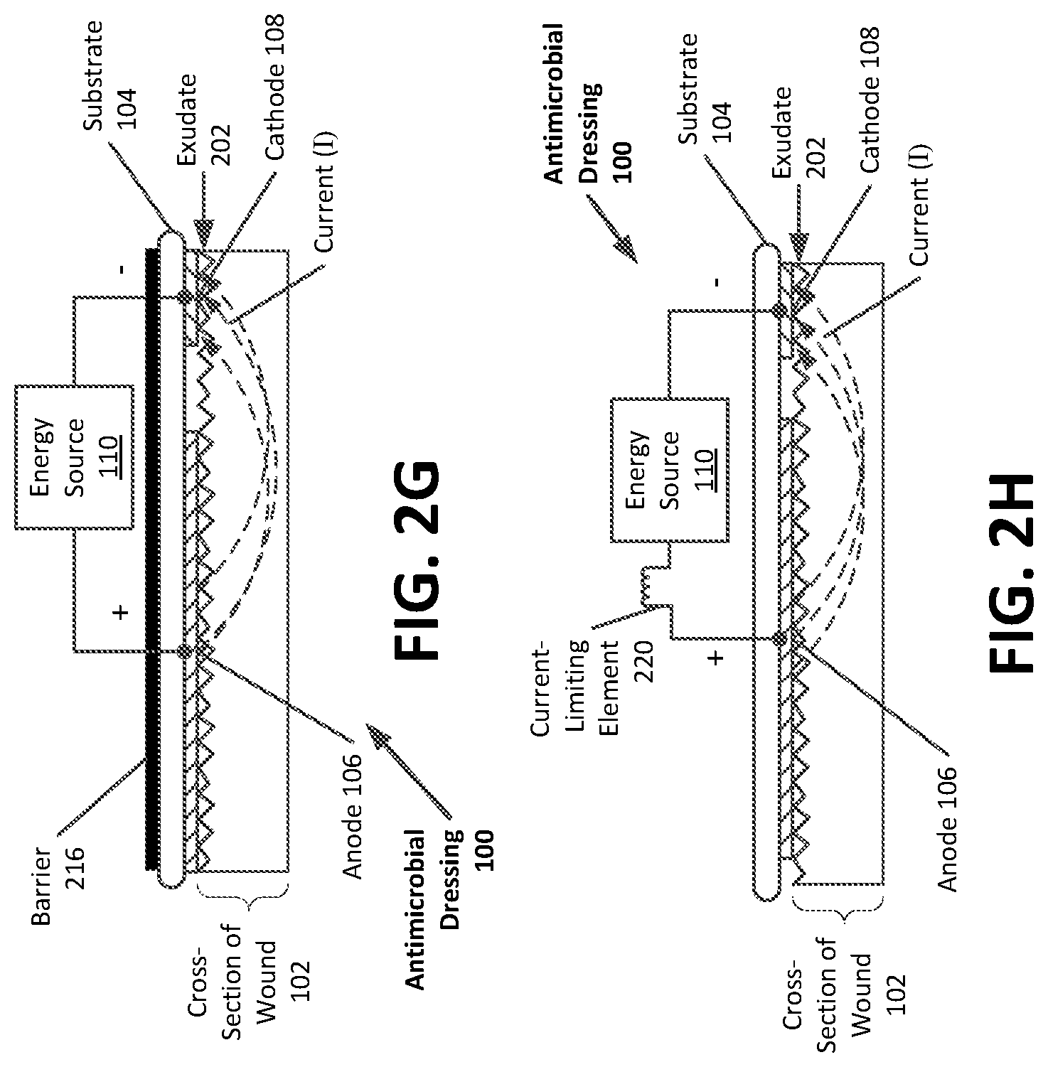 Patent US12102508 Figure 4 – Antimicrobial wound care dressing