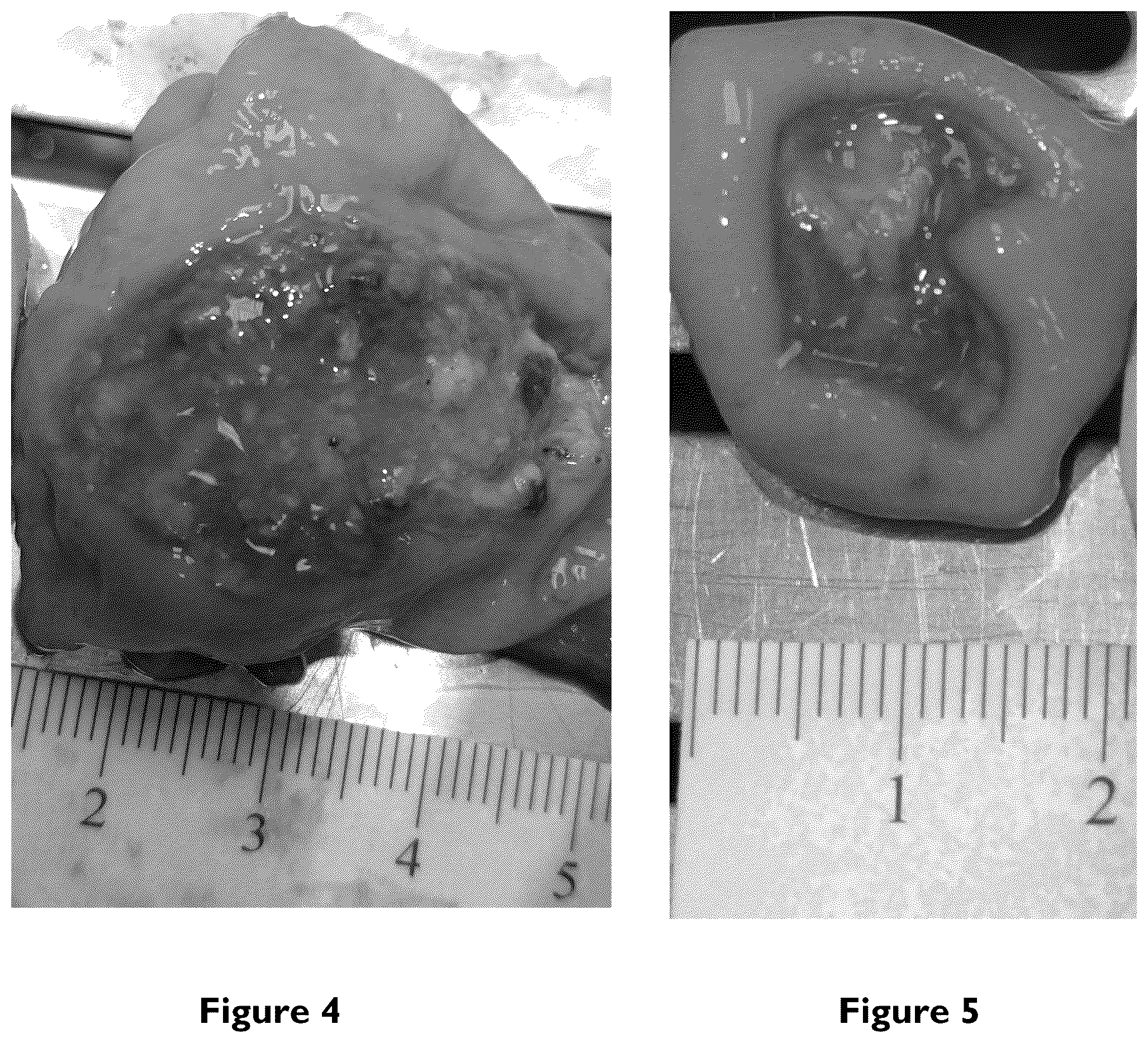 Patent US12102510 Figure 3 – Bimodal treatment methods and compositions for gastrointestinal lesions with active bleeding