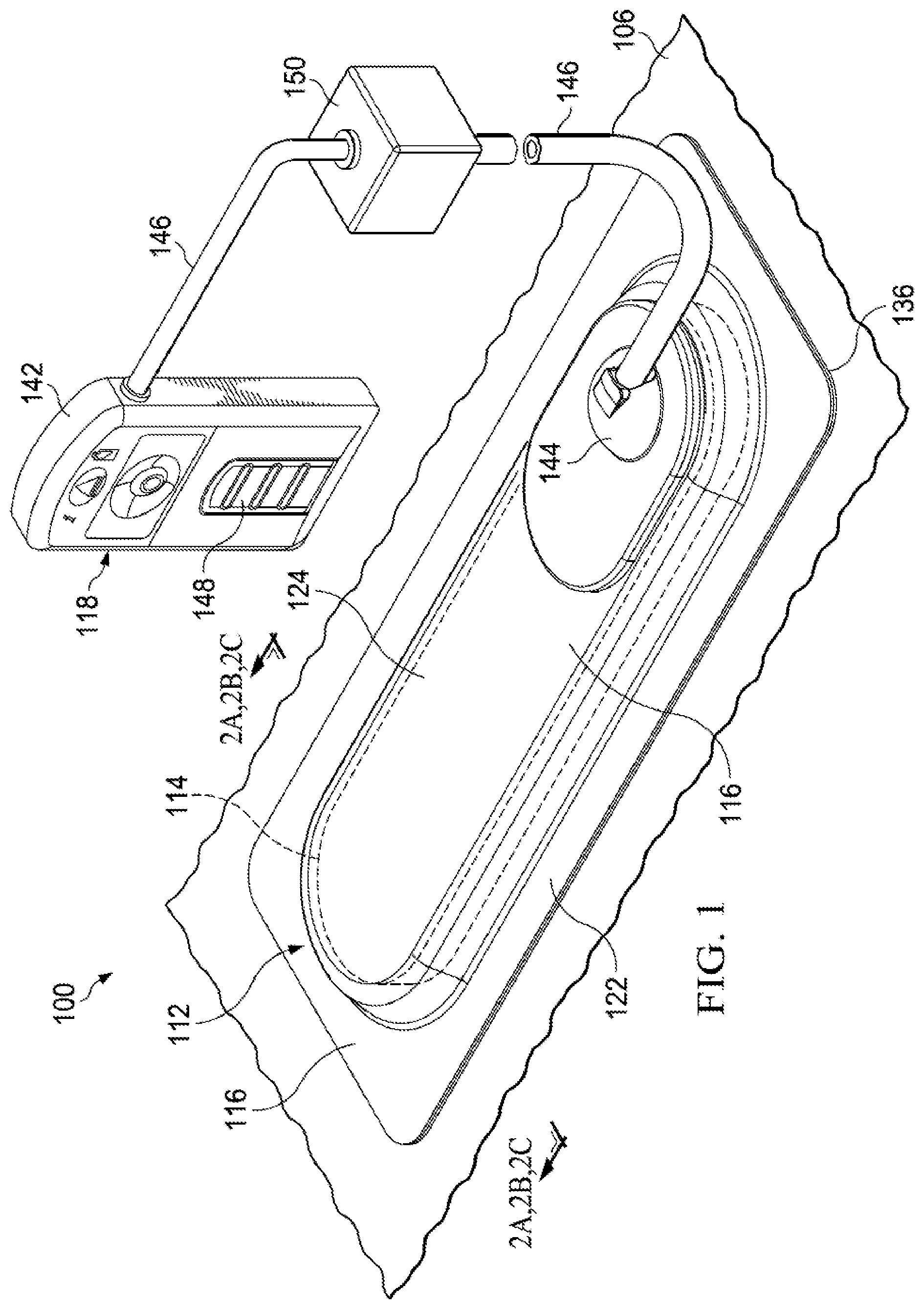 Patent US12102511 Figure 1 – Dressing with variable contraction zones