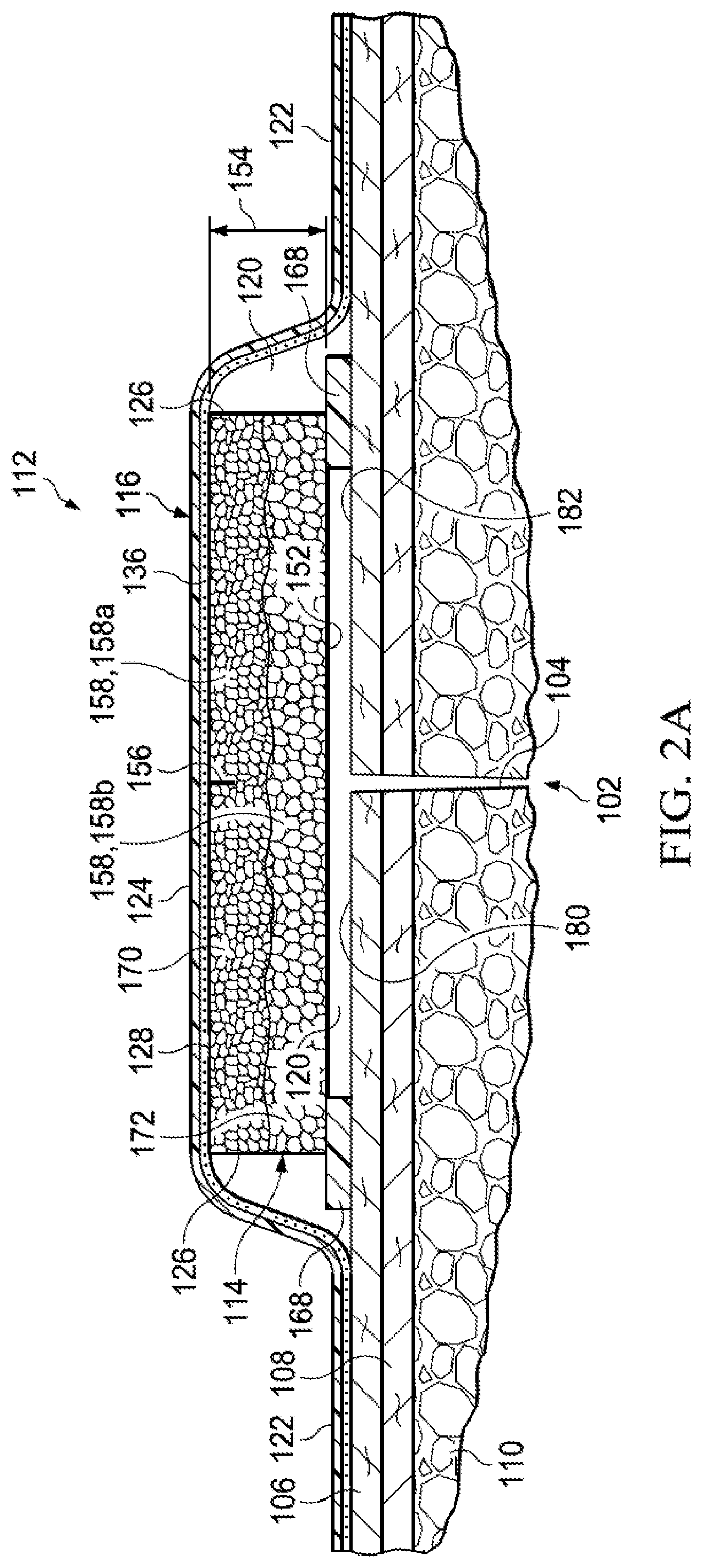 Patent US12102511 Figure 2 – Dressing with variable contraction zones