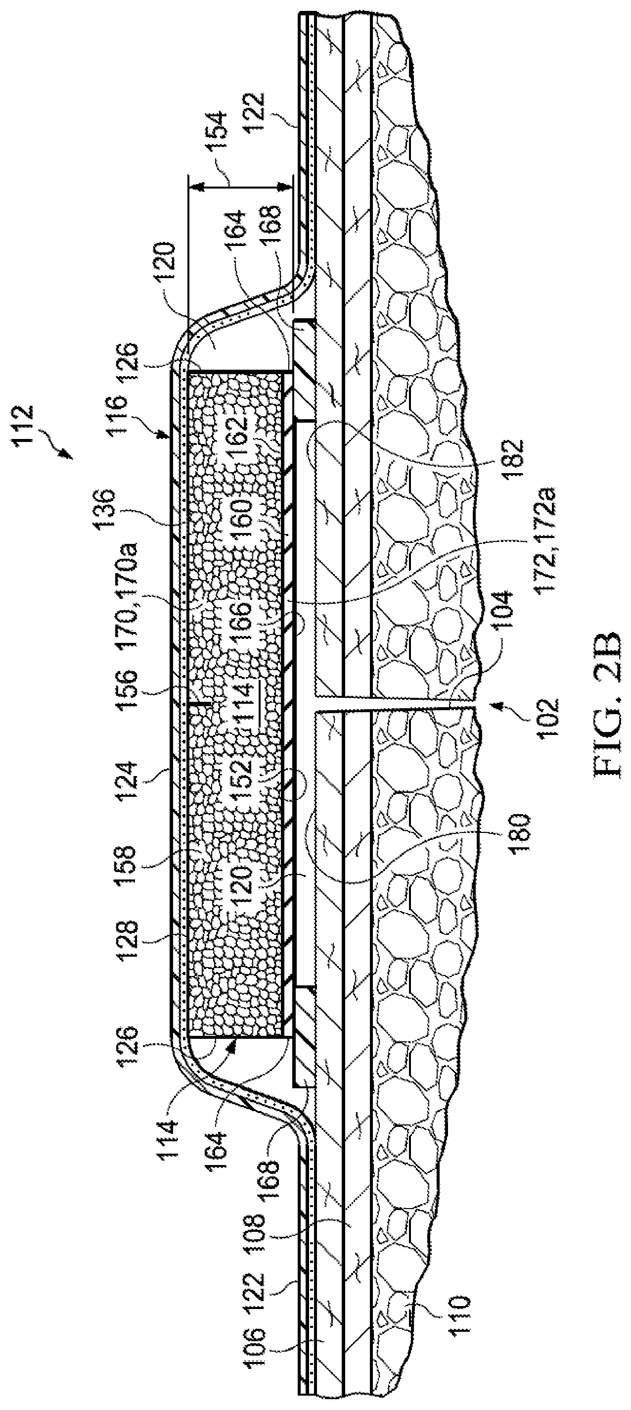 Patent US12102511 Figure 3 – Dressing with variable contraction zones