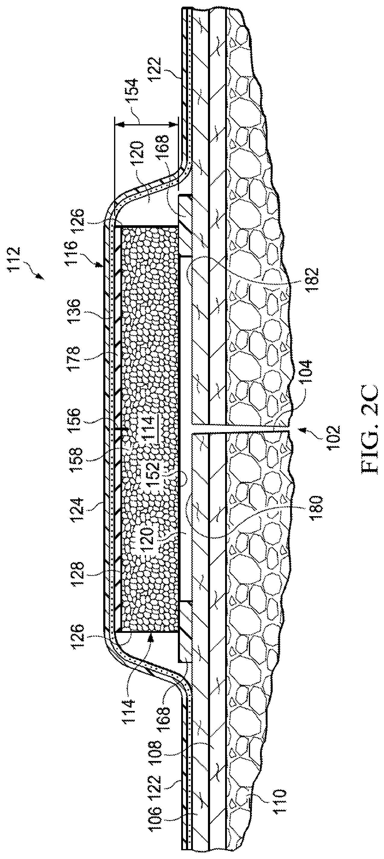 Patent US12102511 Figure 4 – Dressing with variable contraction zones