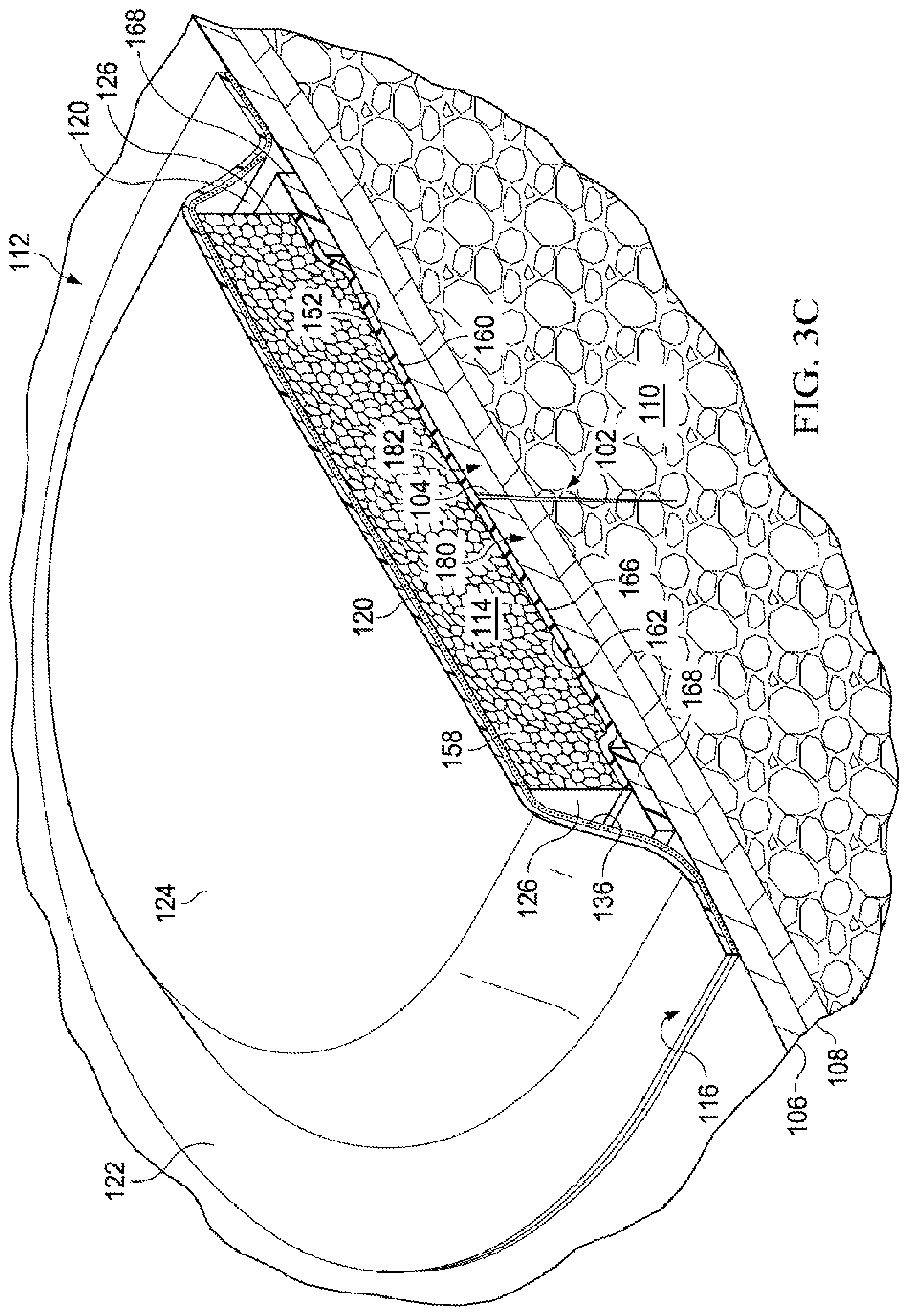 Patent US12102511 Figure 7 – Dressing with variable contraction zones