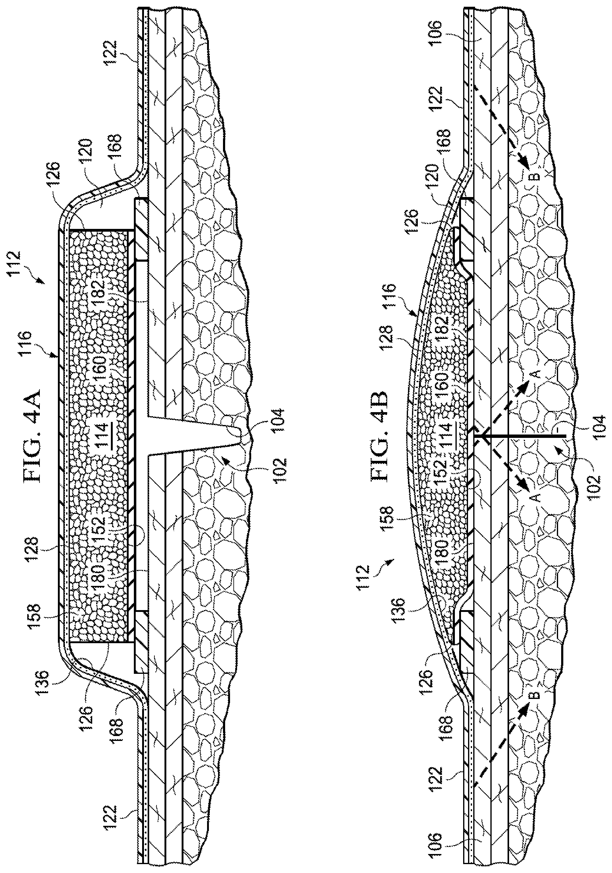 Patent US12102511 Figure 8 – Dressing with variable contraction zones