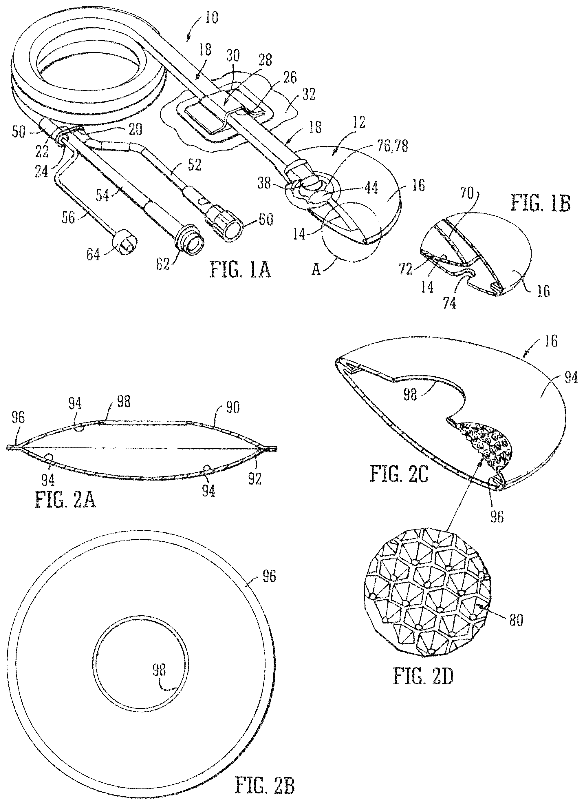 Patent US12102512 Figure 1 – Wound filling apparatuses and methods