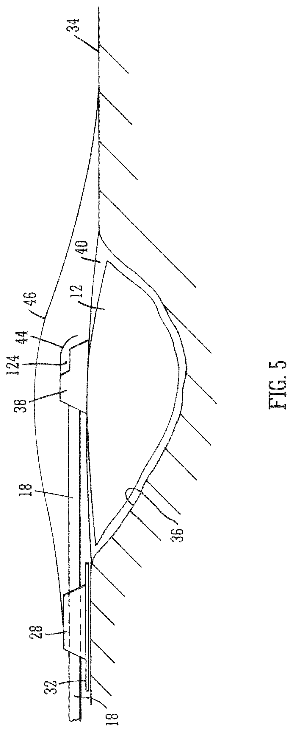 Patent US12102512 Figure 4 – Wound filling apparatuses and methods