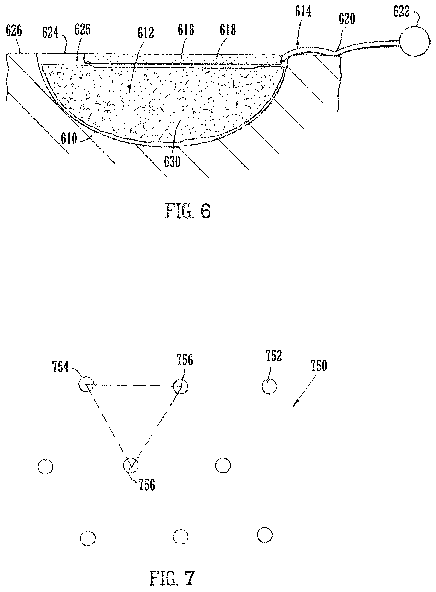 Patent US12102512 Figure 5 – Wound filling apparatuses and methods