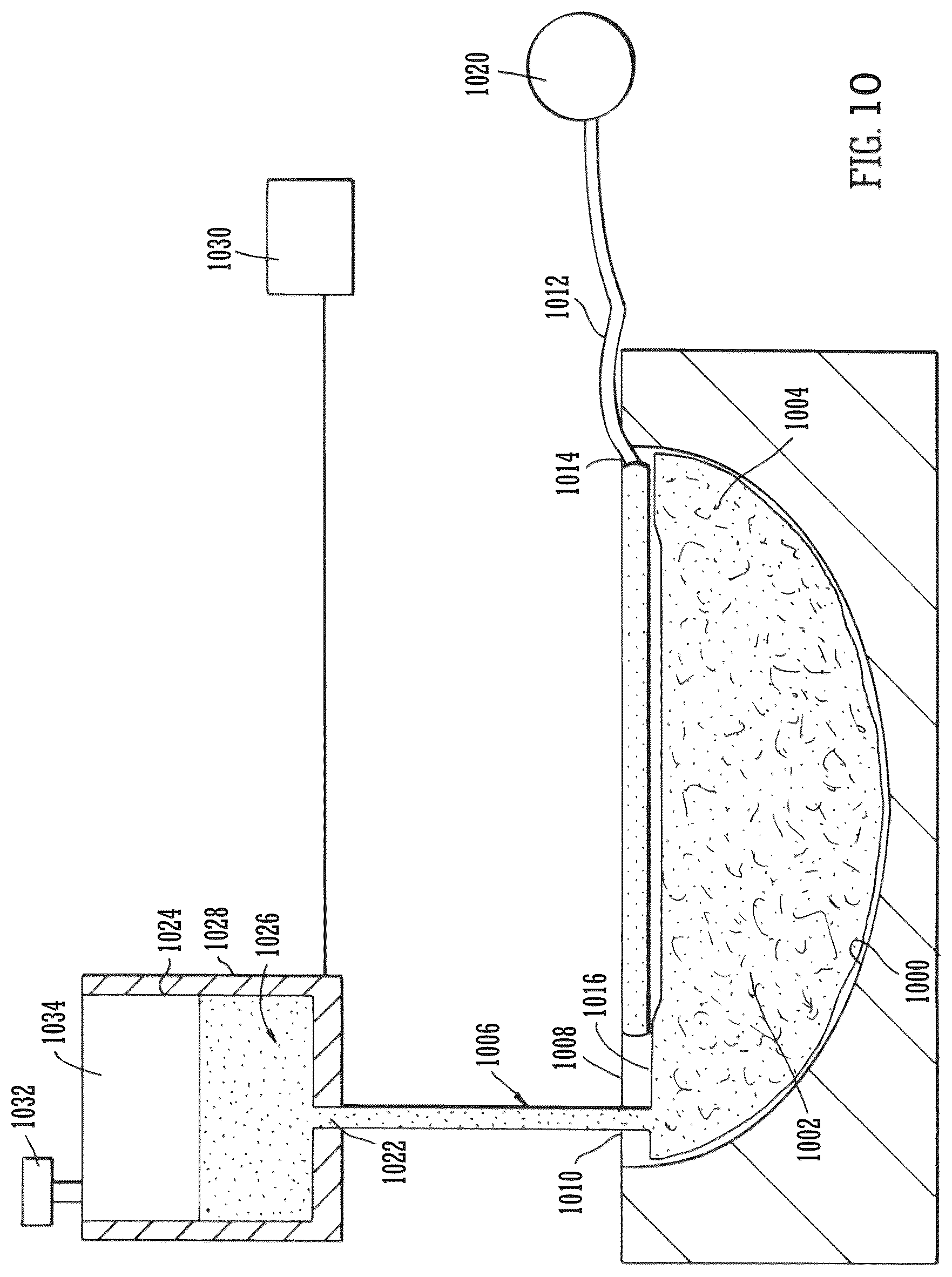 Patent US12102512 Figure 7 – Wound filling apparatuses and methods