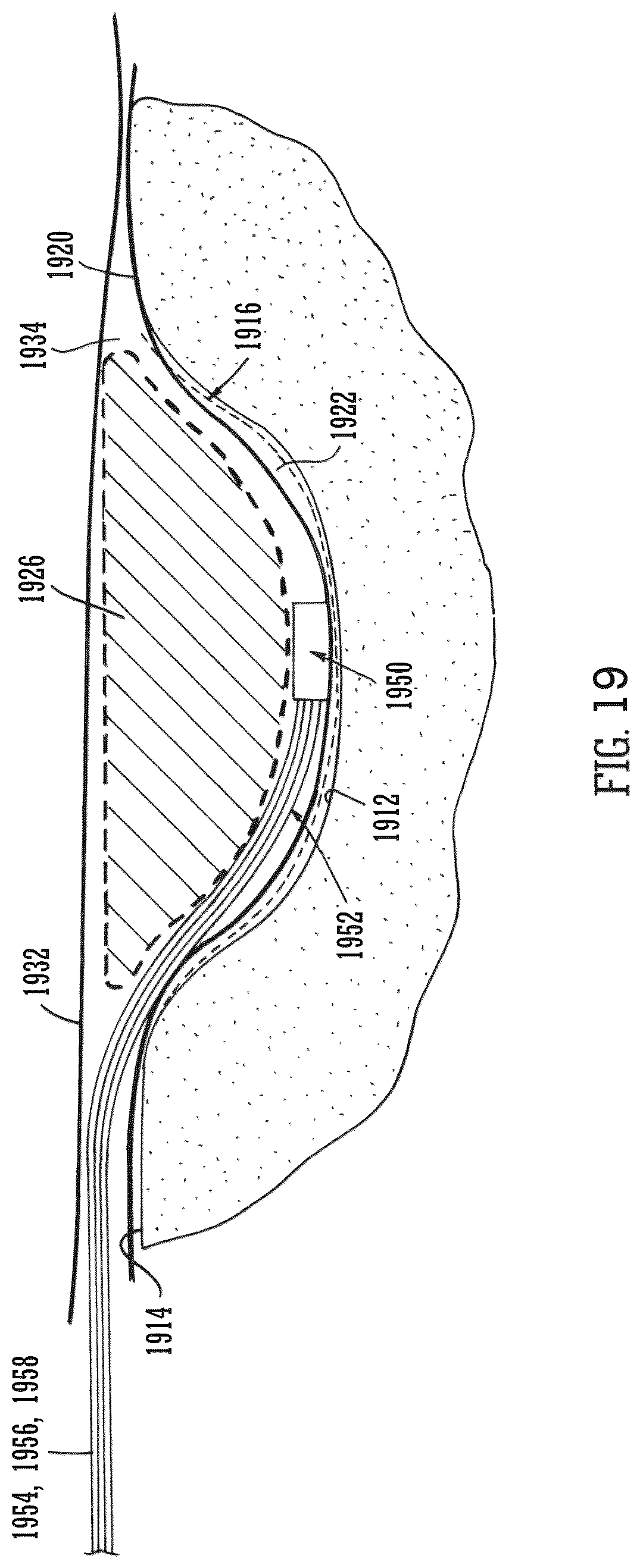 Patent US12102512 Figure 11 – Wound filling apparatuses and methods