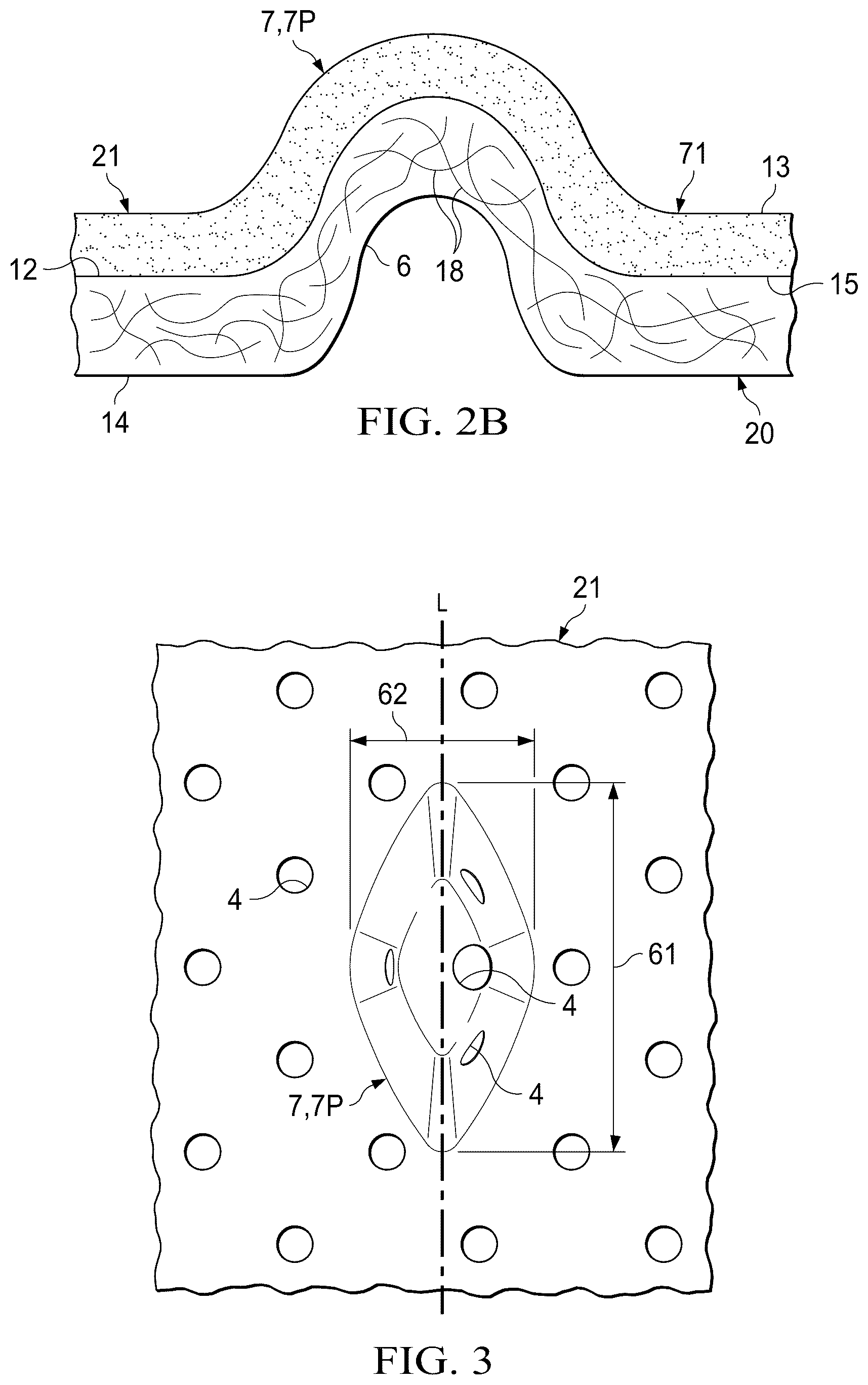 Patent US12102515 Figure 2 – Laminate webs and absorbent articles having the same