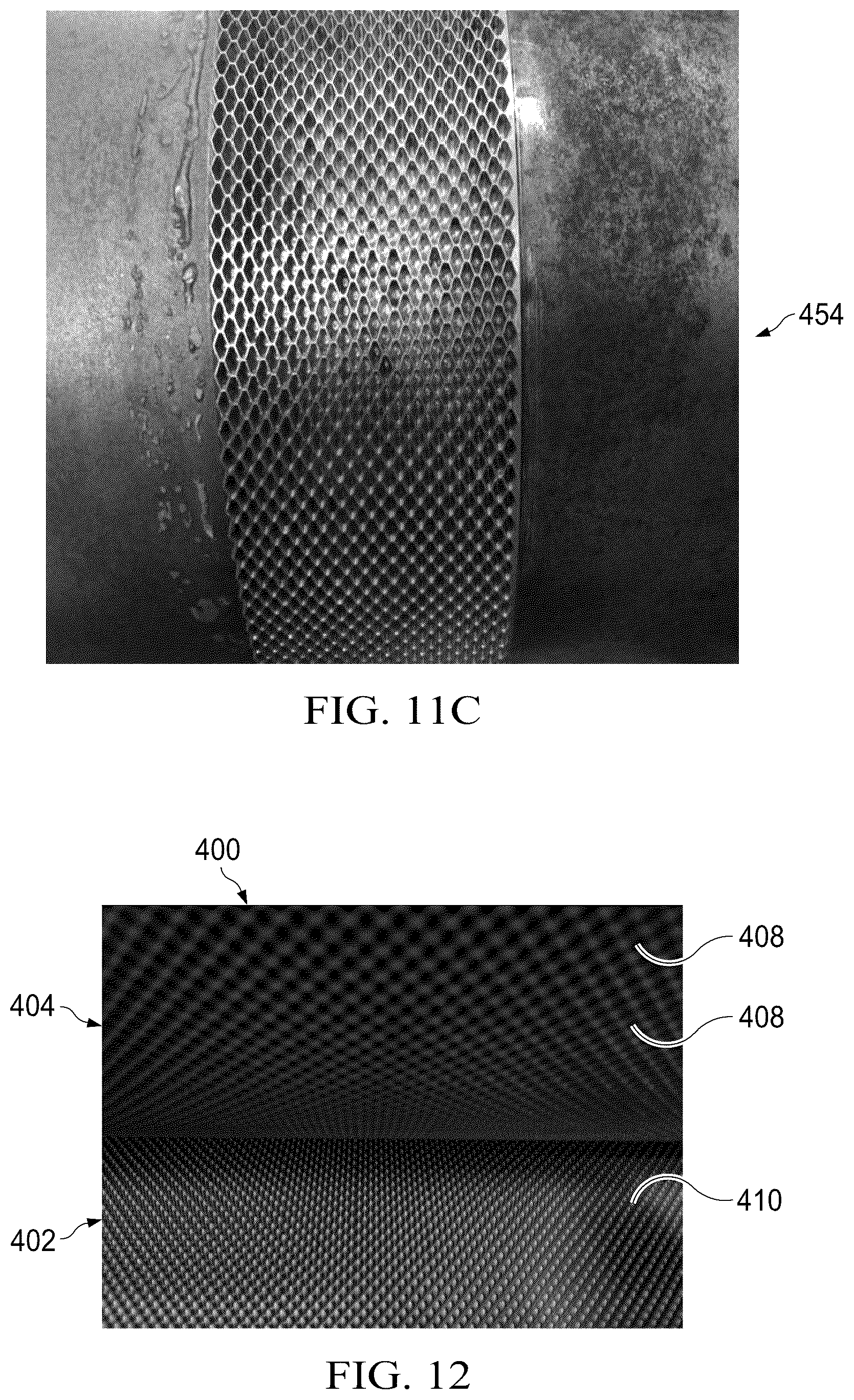 Patent US12102515 Figure 9 – Laminate webs and absorbent articles having the same