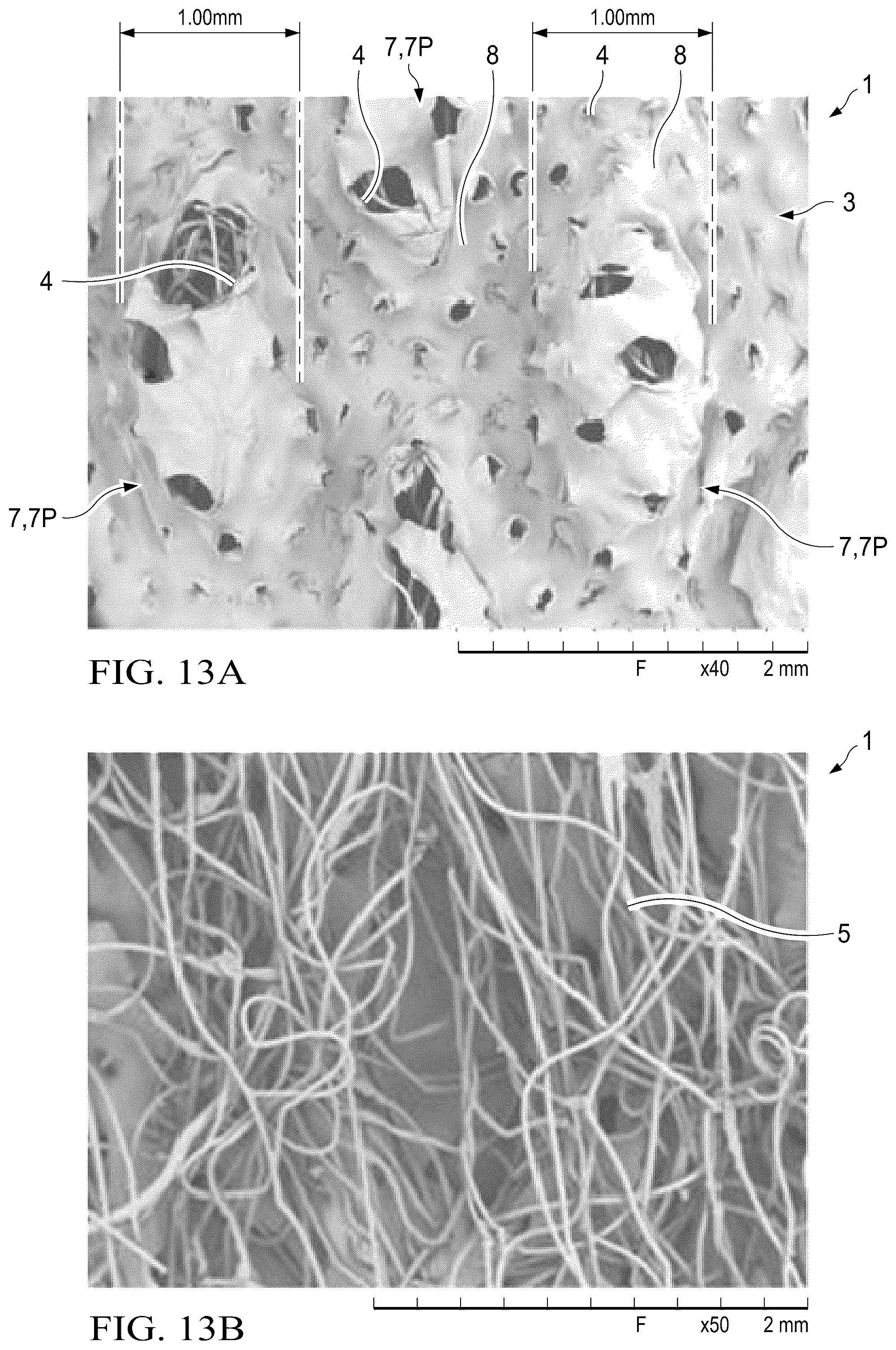 Patent US12102515 Figure 10 – Laminate webs and absorbent articles having the same
