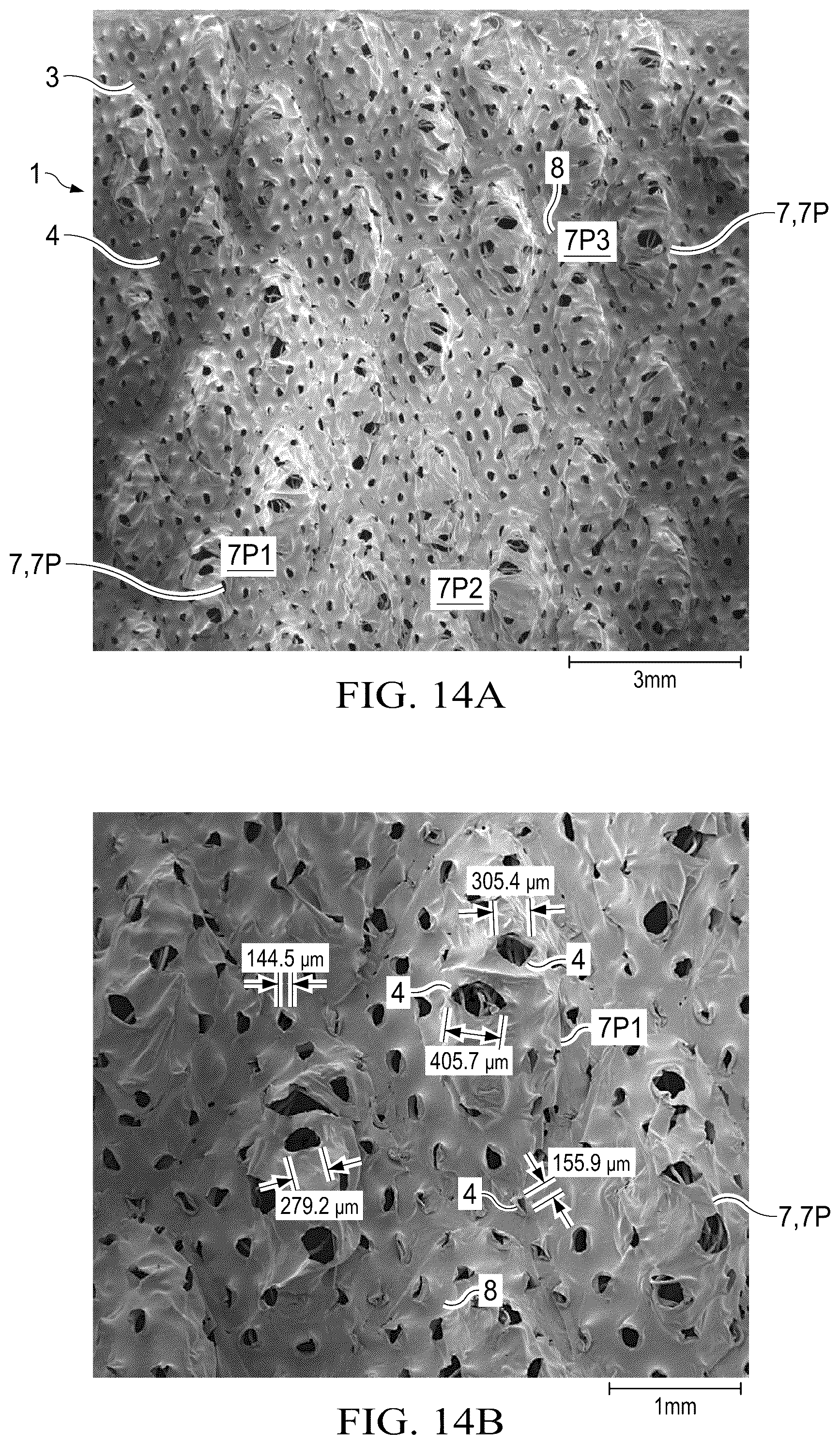Patent US12102515 Figure 11 – Laminate webs and absorbent articles having the same