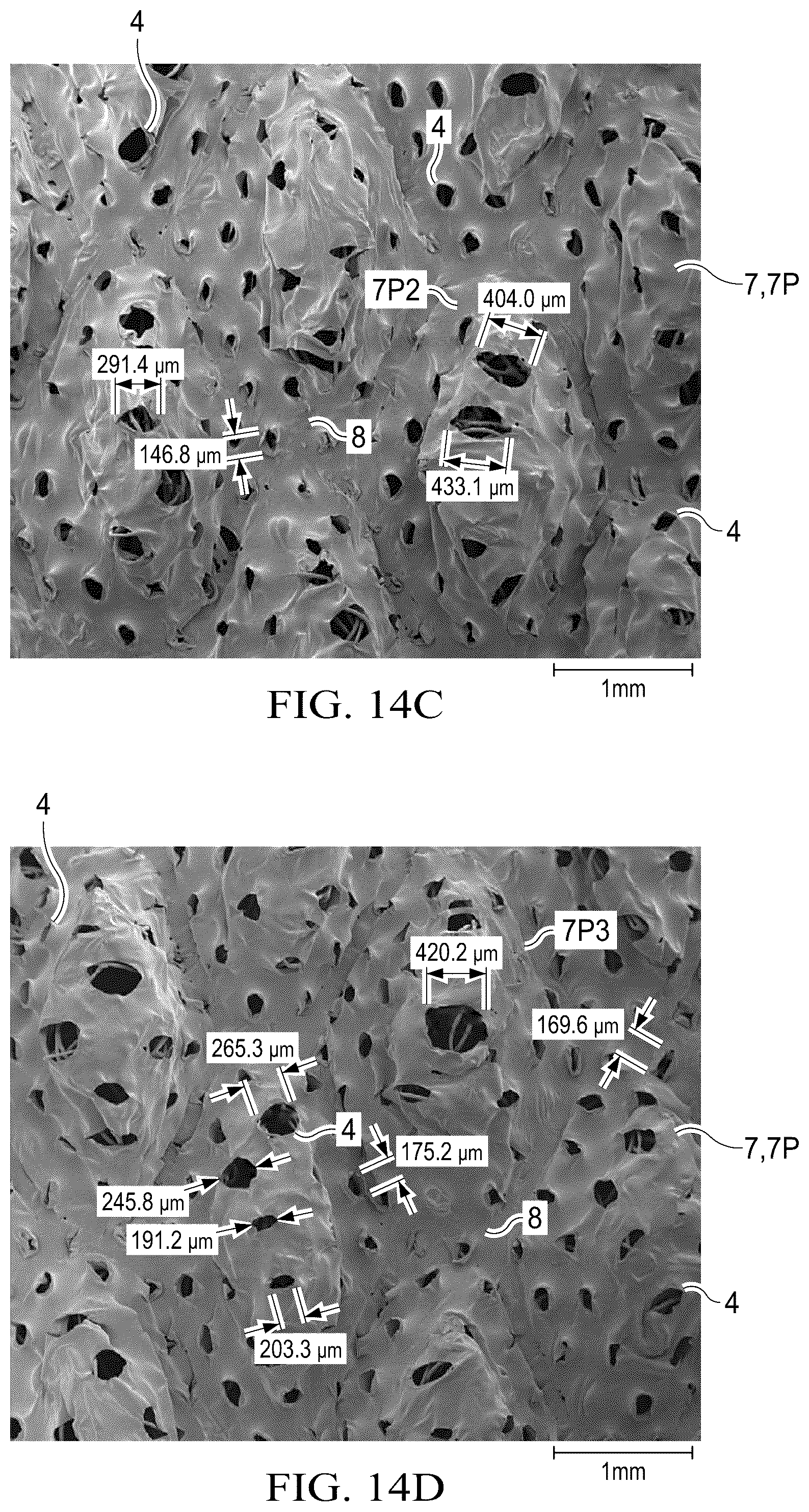 Patent US12102515 Figure 12 – Laminate webs and absorbent articles having the same