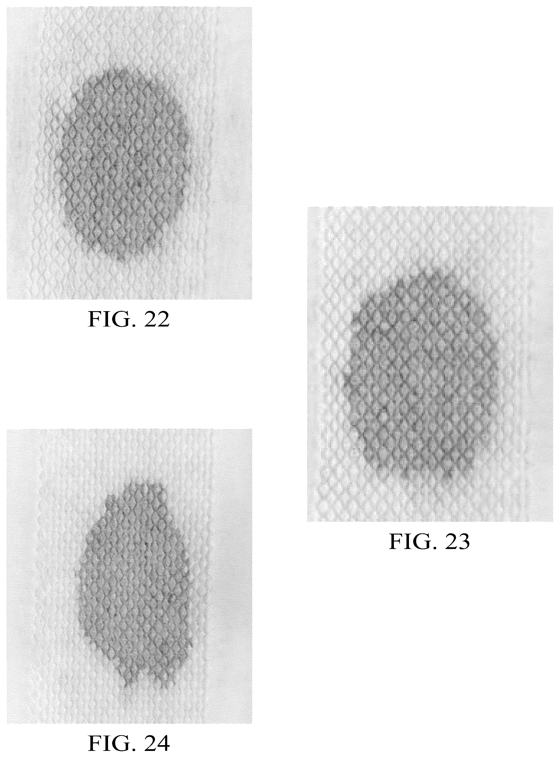 Patent US12102515 Figure 20 – Laminate webs and absorbent articles having the same