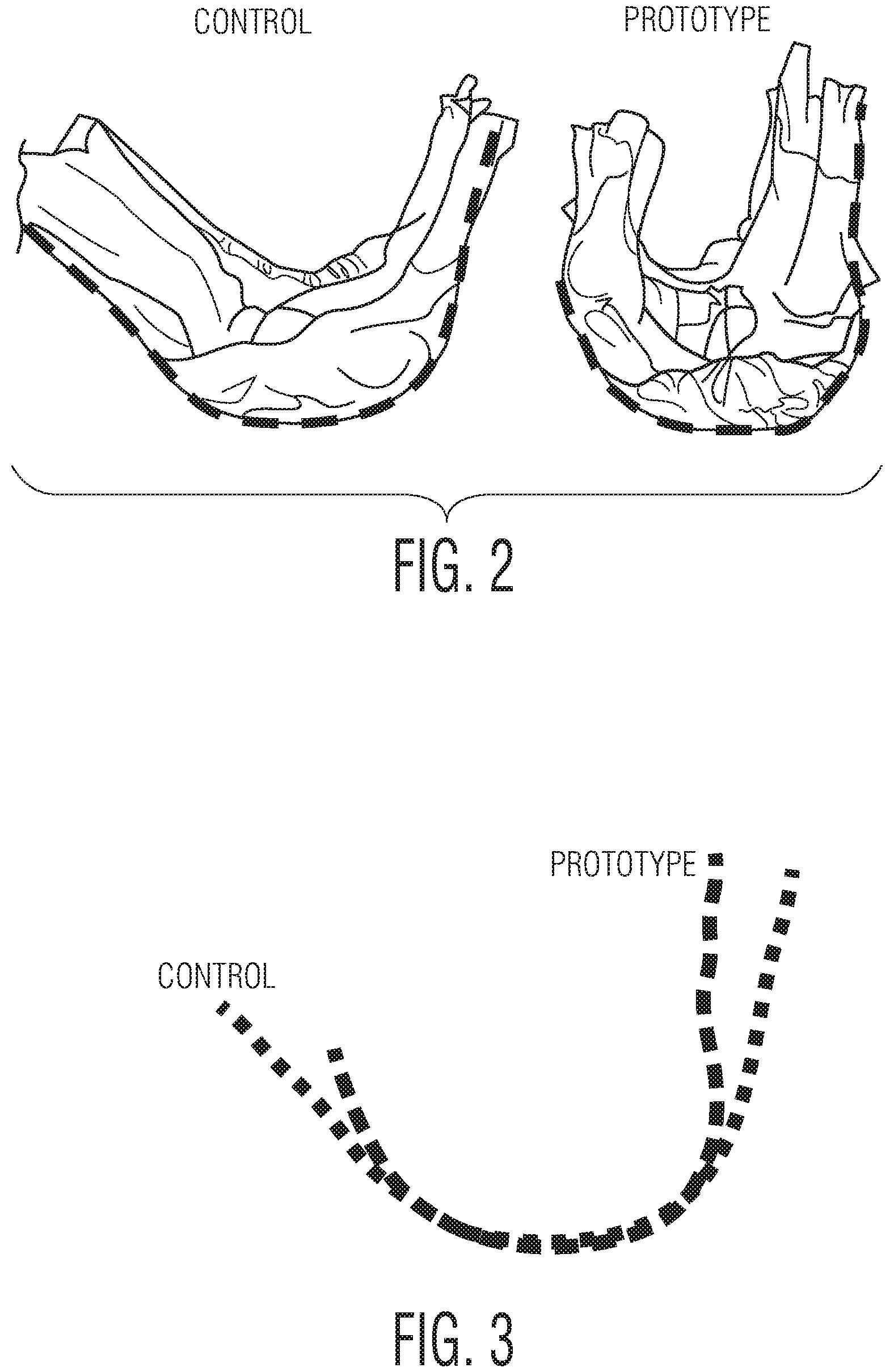 Patent US12102516 Figure 2 – Products with materials that shrink in one dimension and expand in another dimension