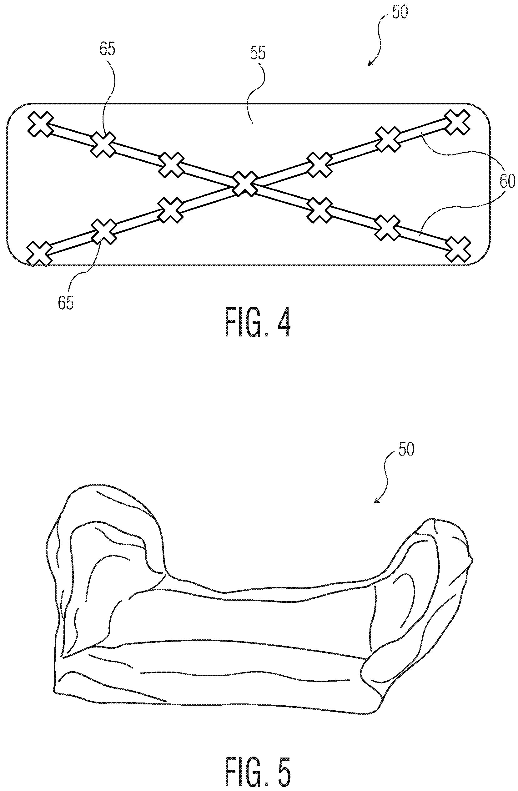 Patent US12102516 Figure 3 – Products with materials that shrink in one dimension and expand in another dimension