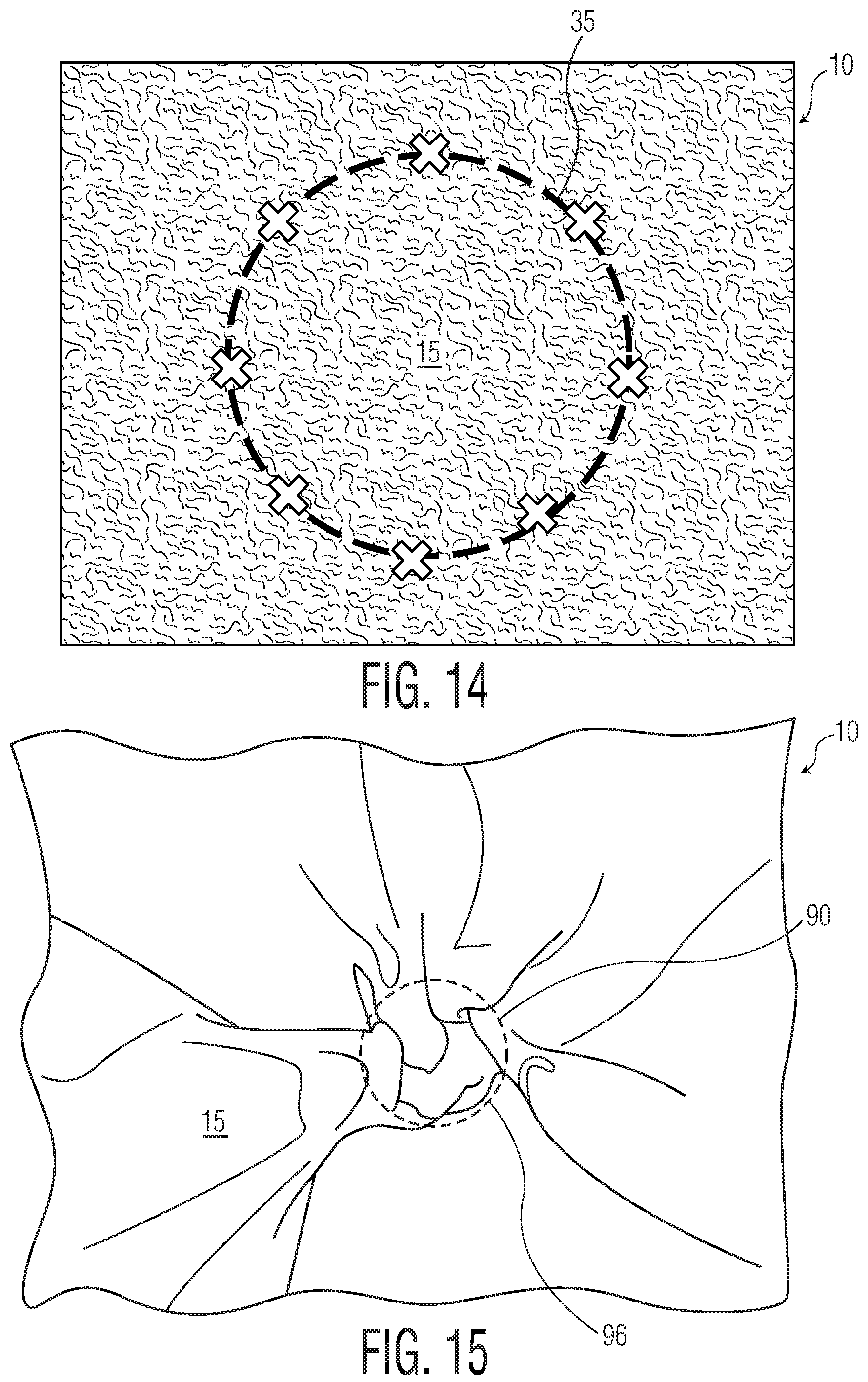 Patent US12102516 Figure 8 – Products with materials that shrink in one dimension and expand in another dimension