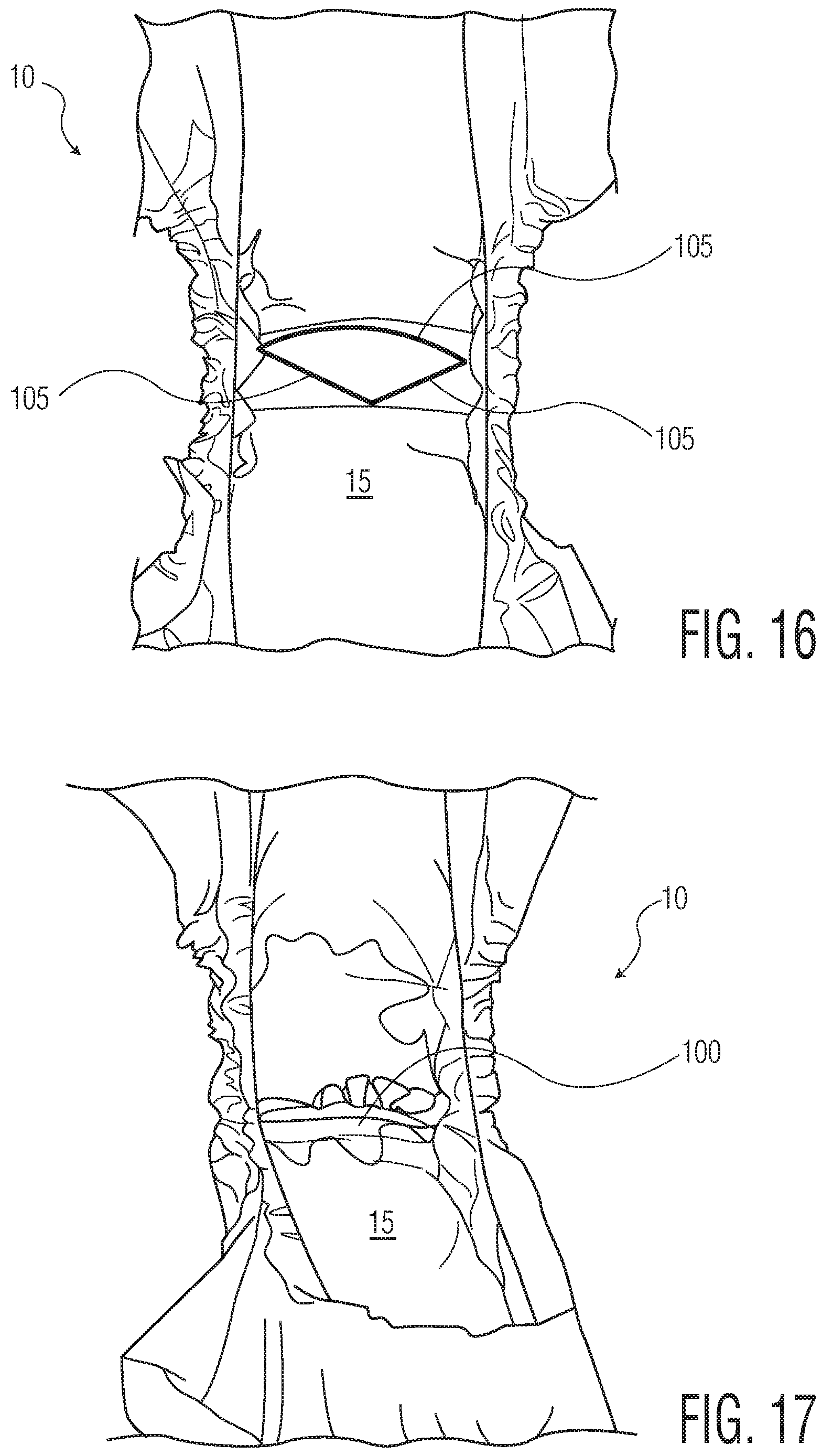 Patent US12102516 Figure 9 – Products with materials that shrink in one dimension and expand in another dimension