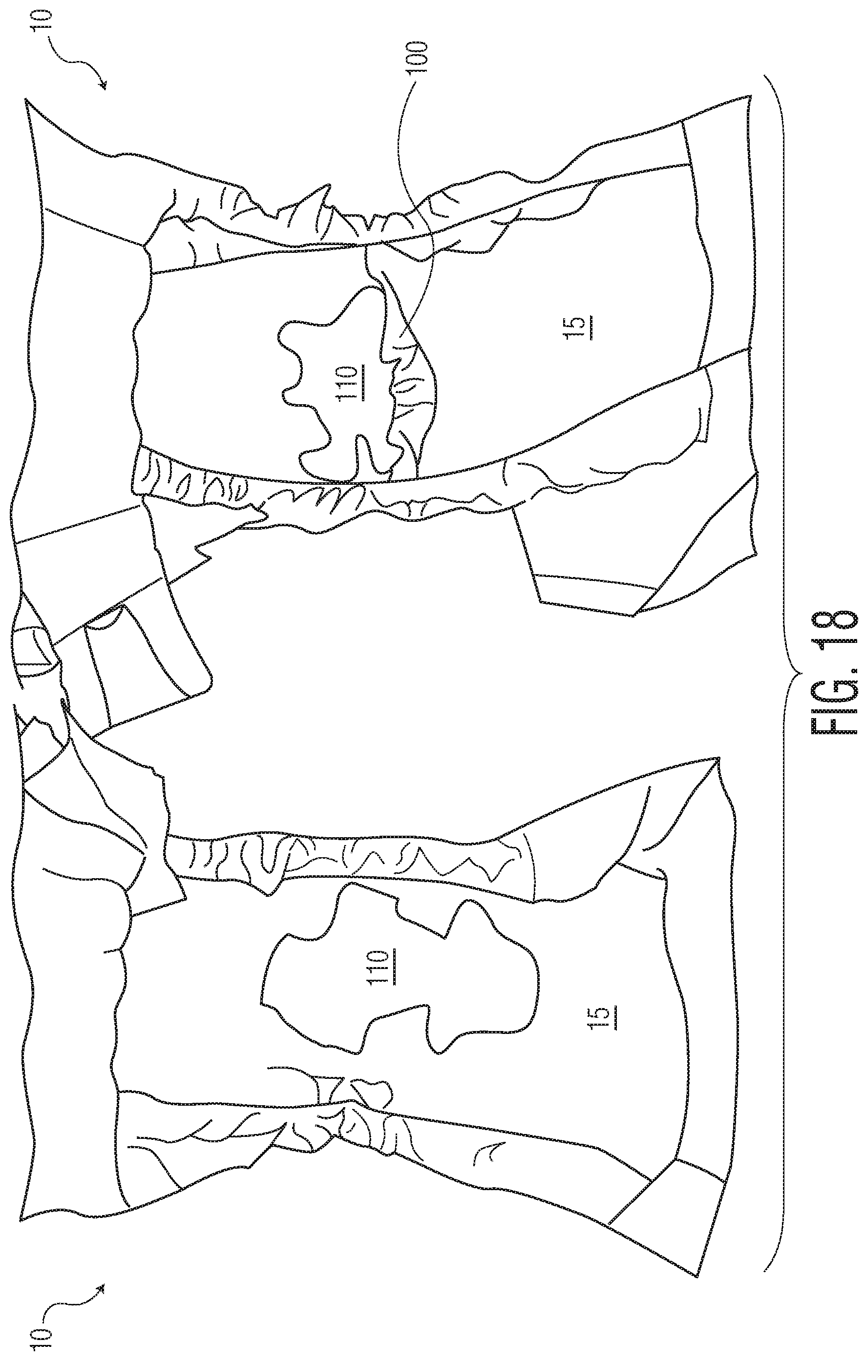 Patent US12102516 Figure 10 – Products with materials that shrink in one dimension and expand in another dimension