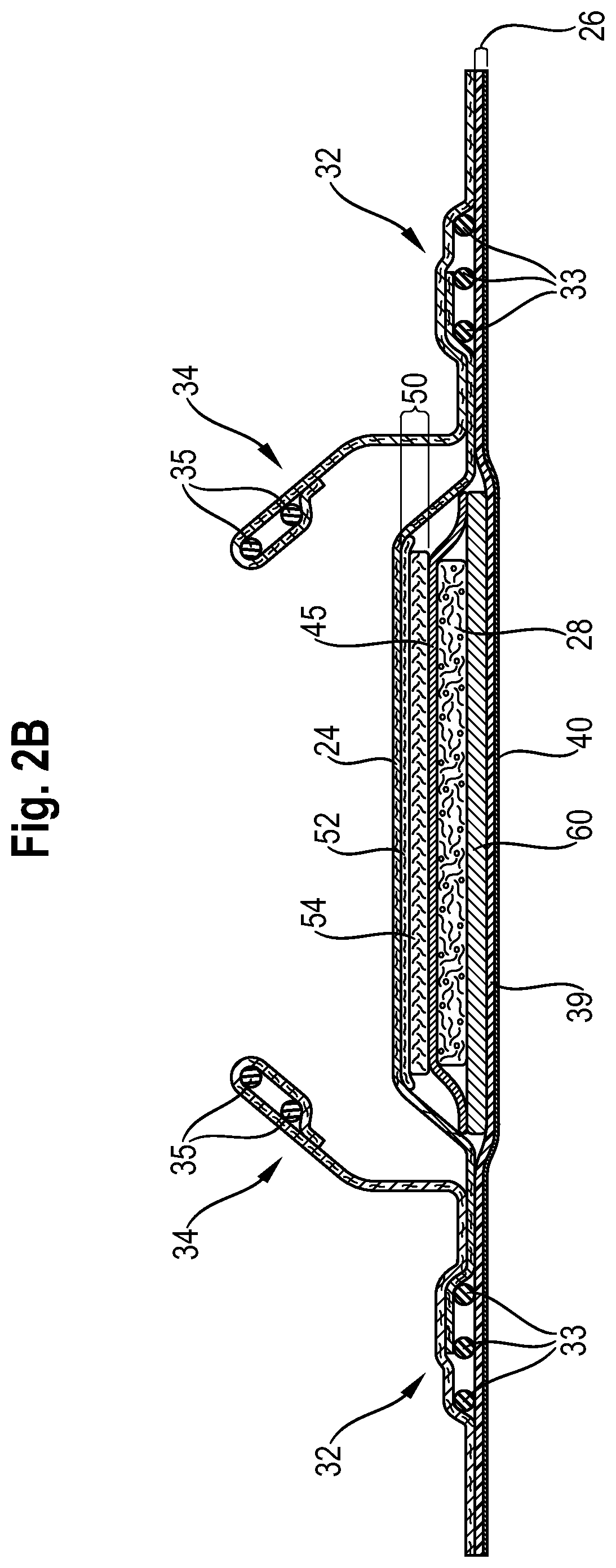 Patent US12102517 Figure 3 – Absorbent article comprising a lower acquisition and distribution system