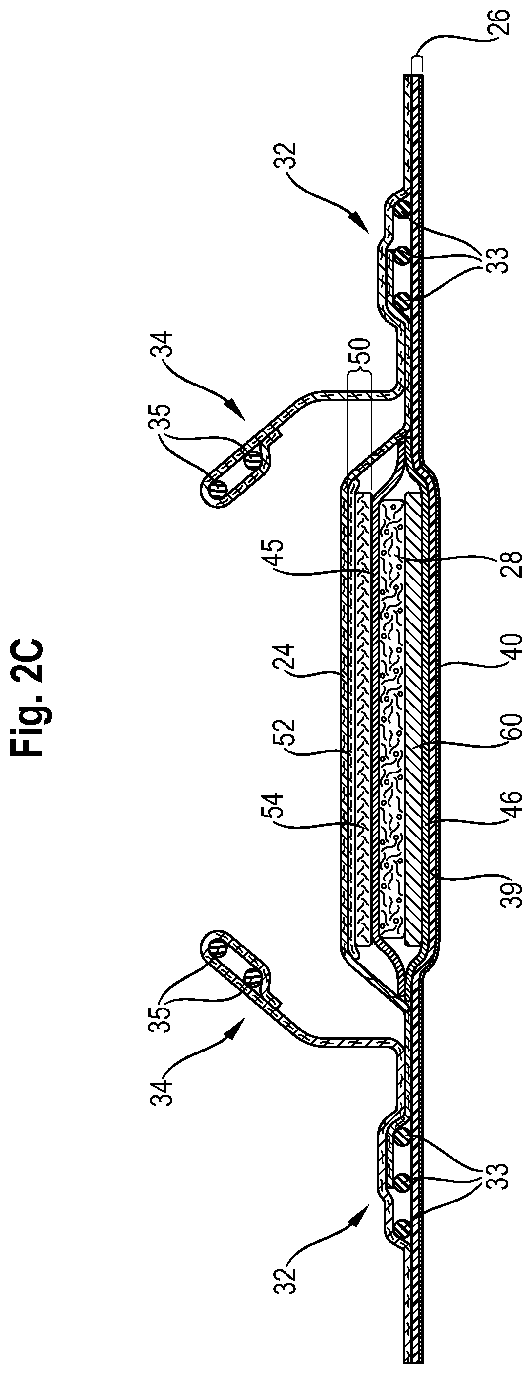 Patent US12102517 Figure 4 – Absorbent article comprising a lower acquisition and distribution system