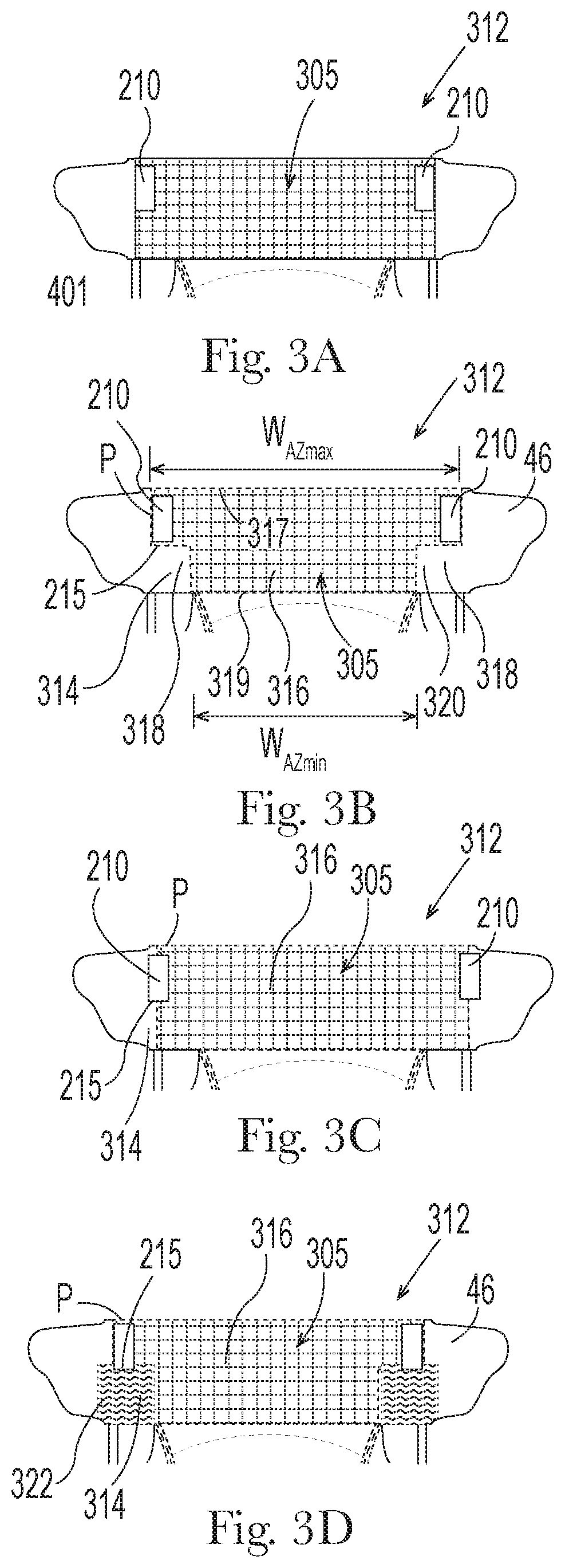 Patent US12102518 Figure 4 – Absorbent article having fastening system