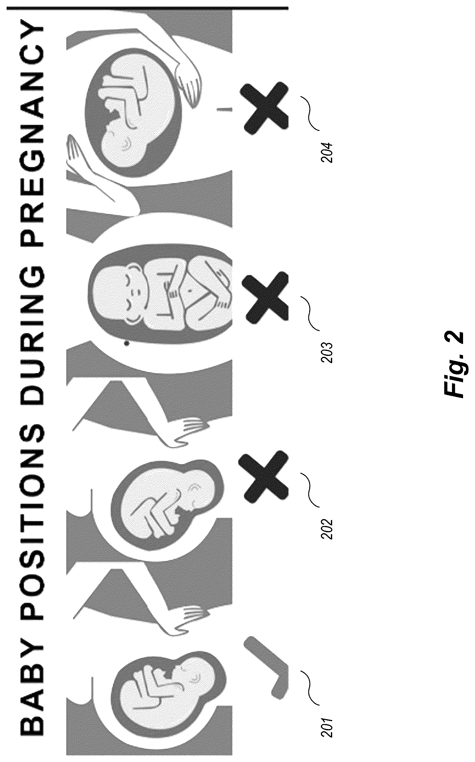 Patent US12102519 Figure 2 – Methods and techniques for treating facial assymetry by administering dermal injections to patients based upon gestational patterns