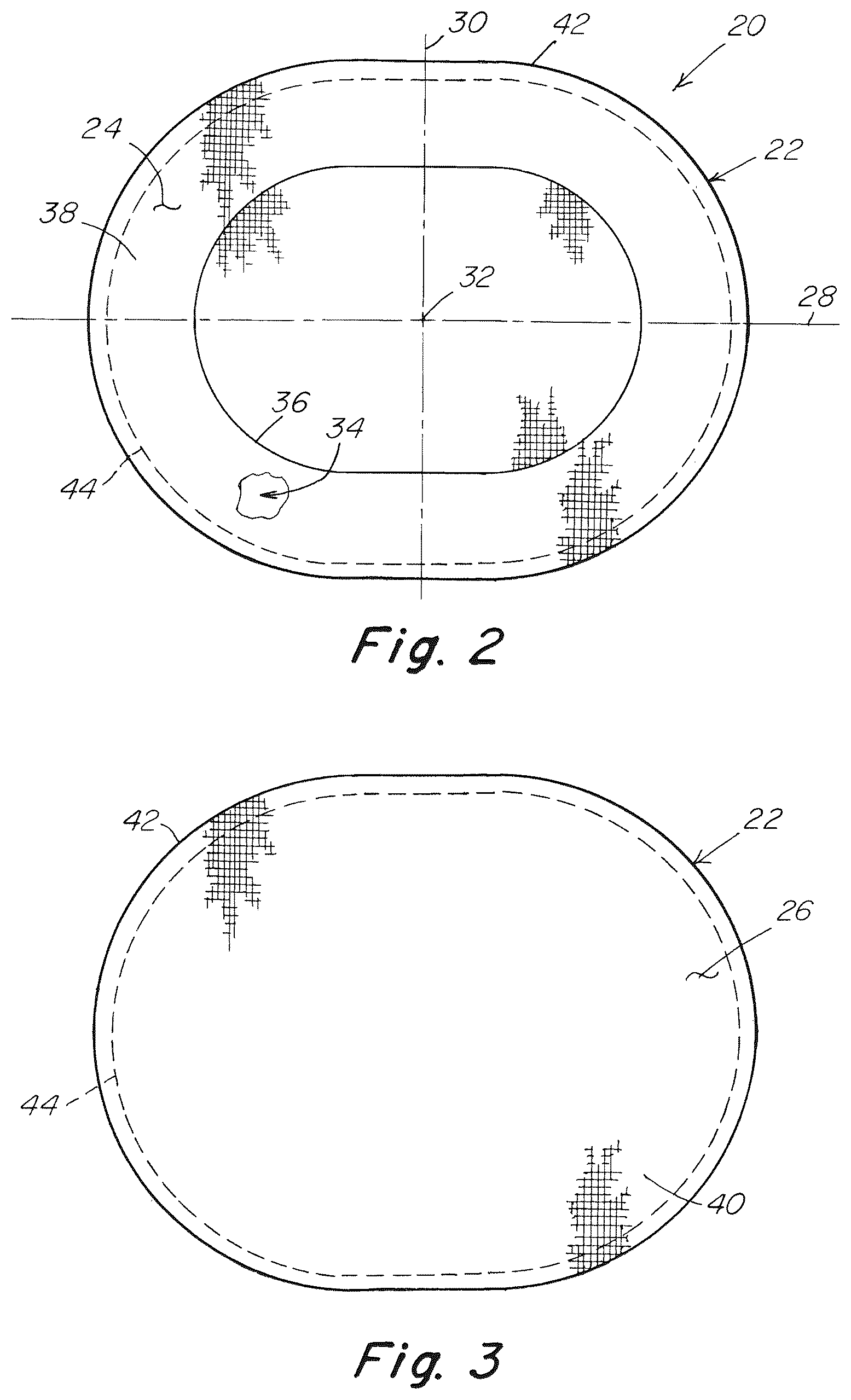 Patent US12102520 Figure 2 – Deployment device for a soft tissue repair prosthesis