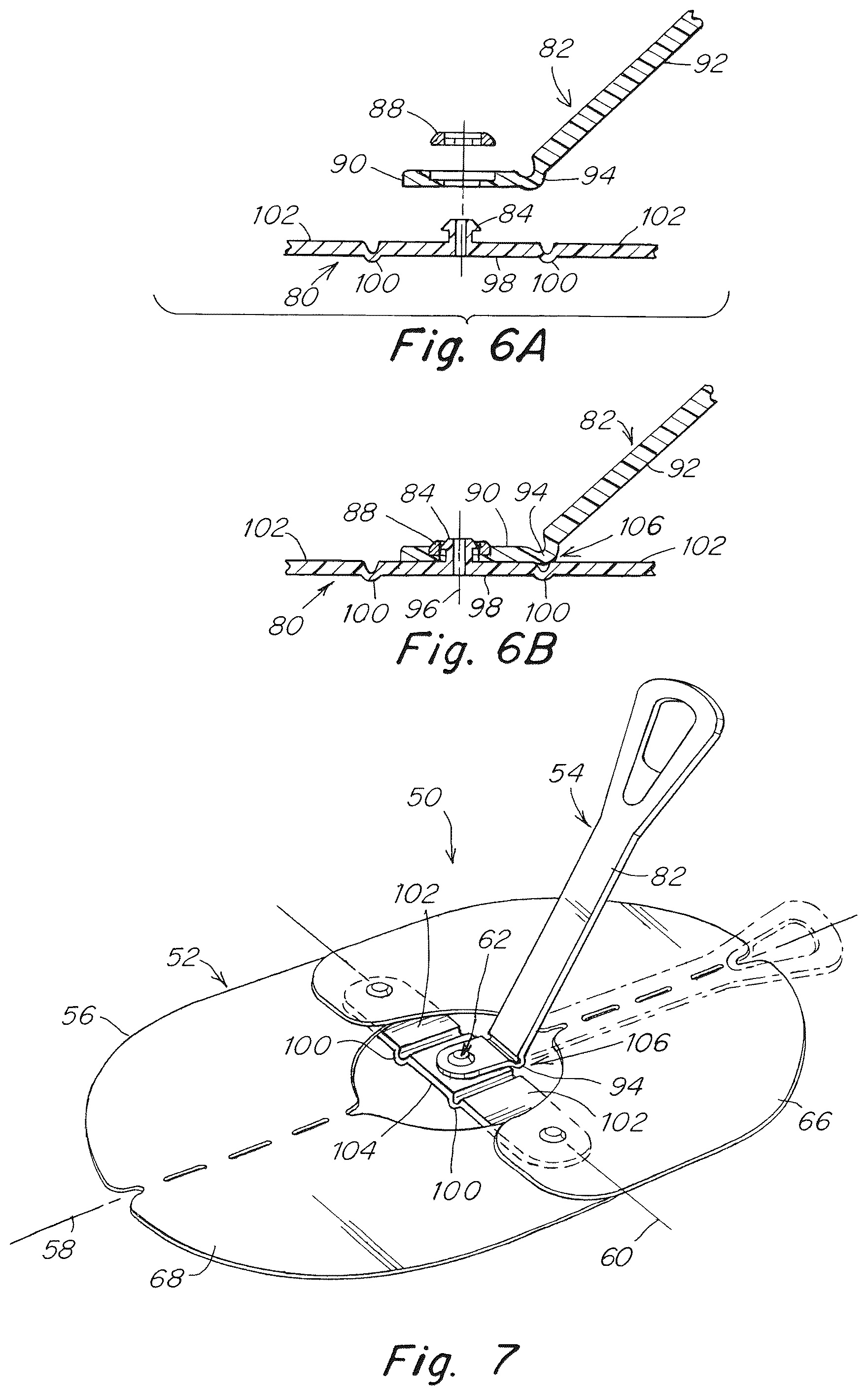 Patent US12102520 Figure 4 – Deployment device for a soft tissue repair prosthesis