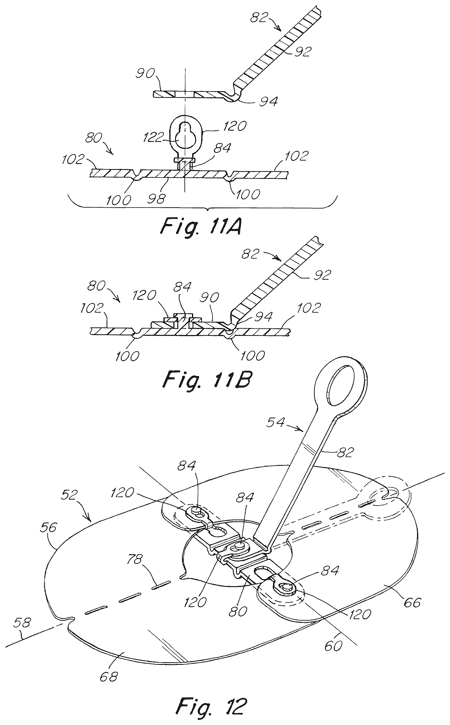 Patent US12102520 Figure 8 – Deployment device for a soft tissue repair prosthesis