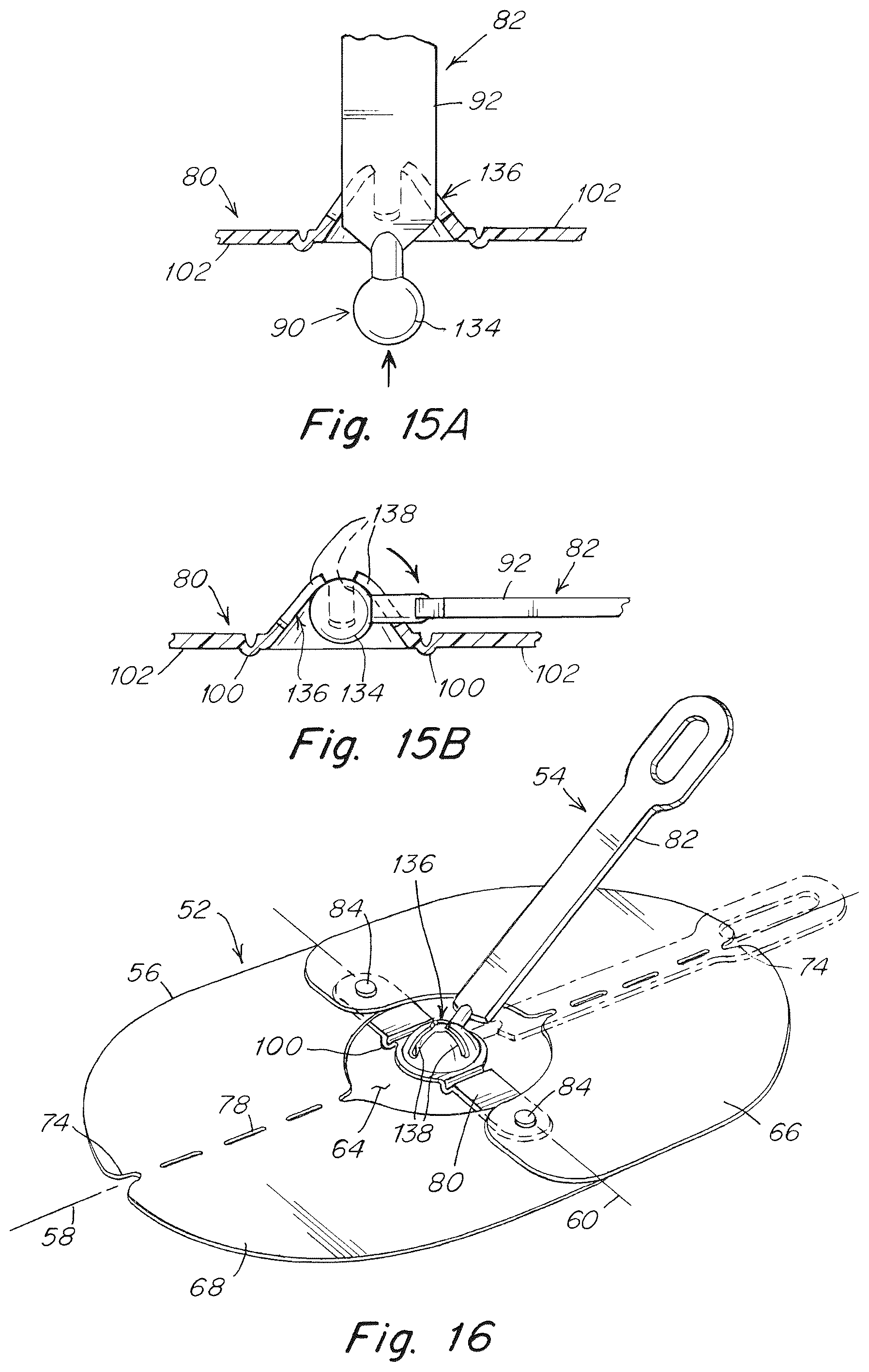 Patent US12102520 Figure 10 – Deployment device for a soft tissue repair prosthesis