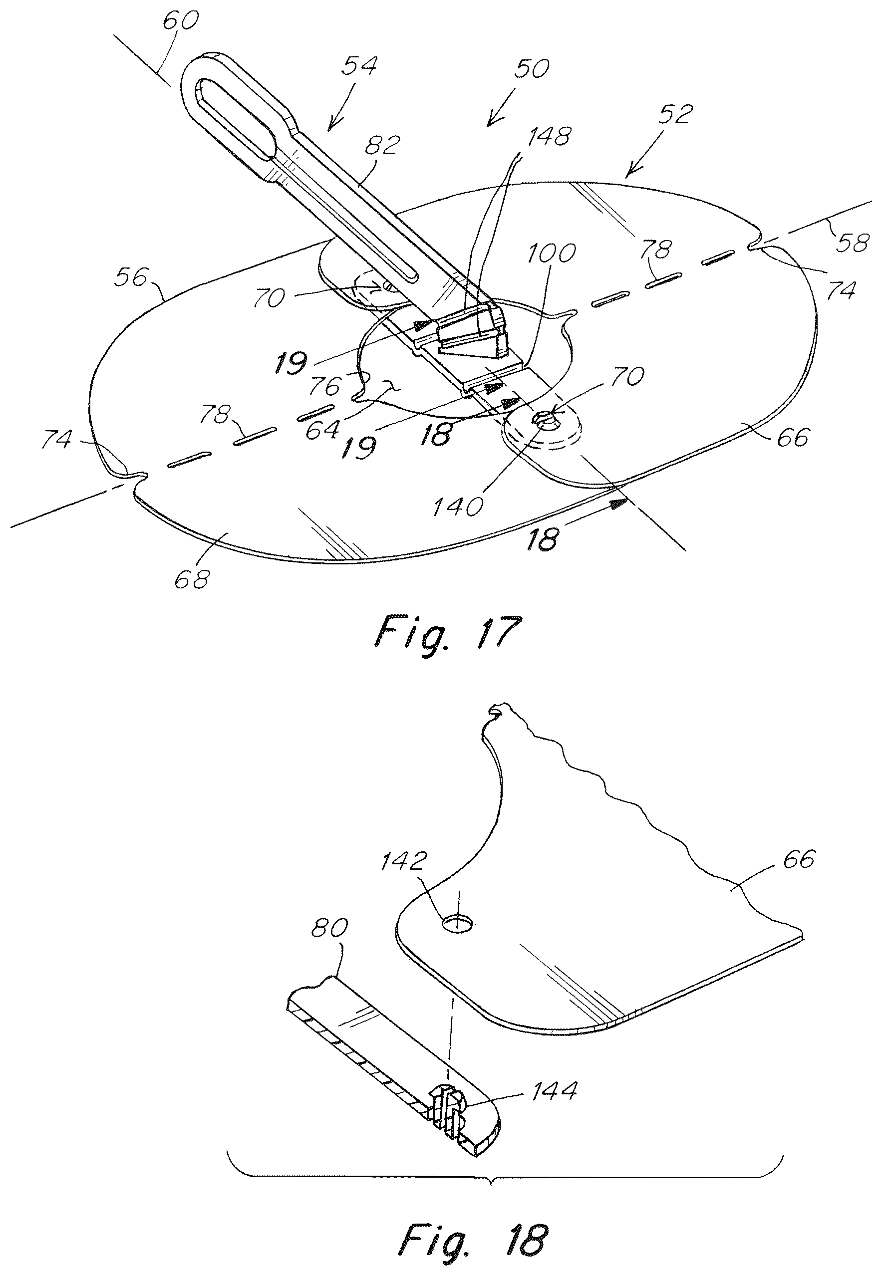 Patent US12102520 Figure 11 – Deployment device for a soft tissue repair prosthesis
