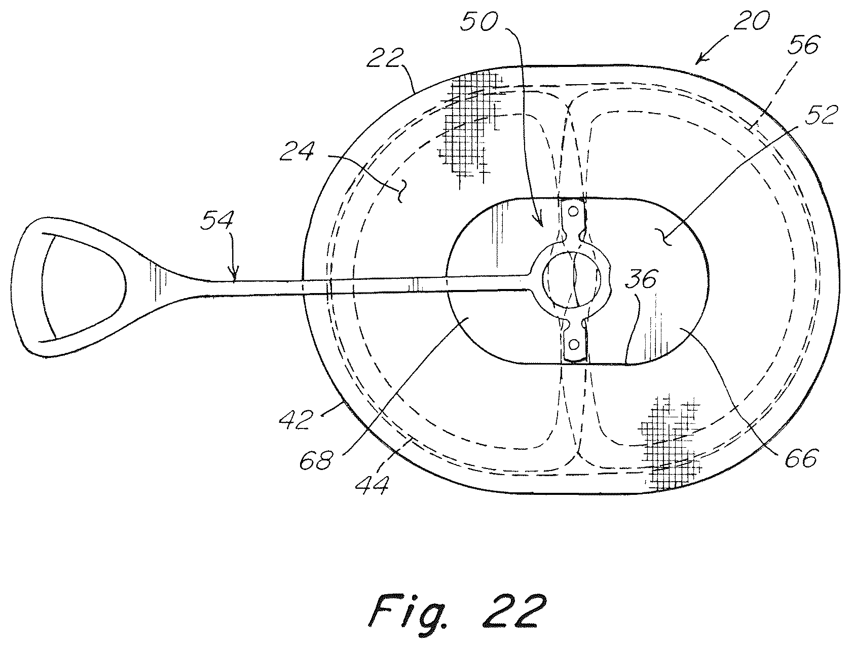 Patent US12102520 Figure 13 – Deployment device for a soft tissue repair prosthesis