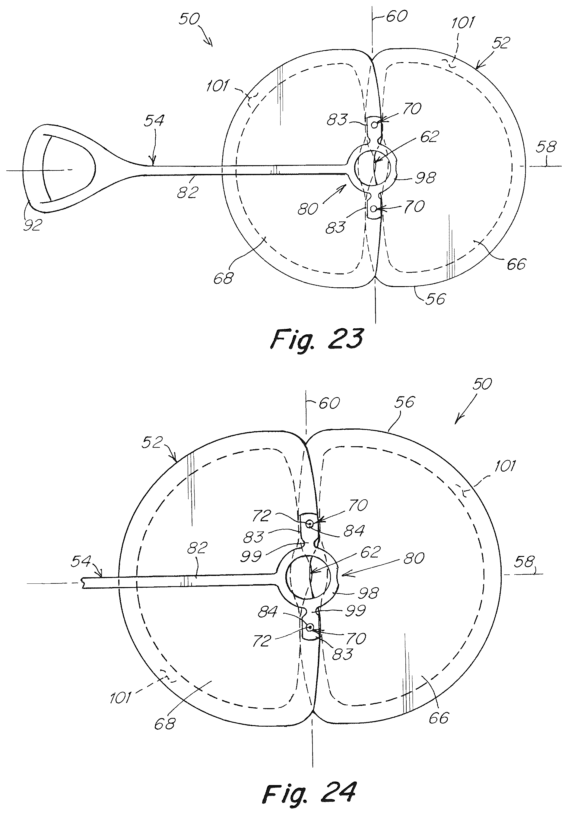 Patent US12102520 Figure 14 – Deployment device for a soft tissue repair prosthesis