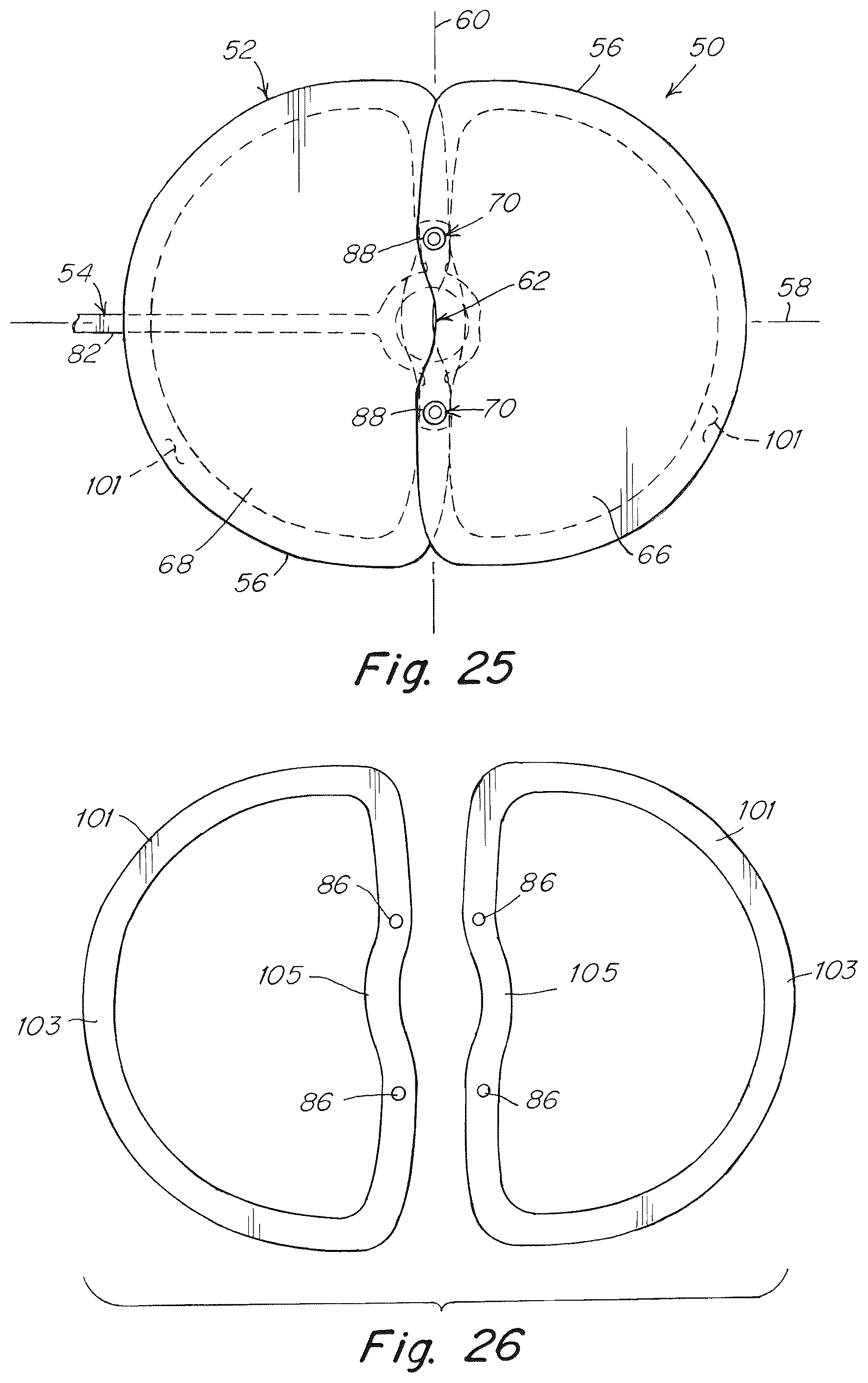 Patent US12102520 Figure 15 – Deployment device for a soft tissue repair prosthesis
